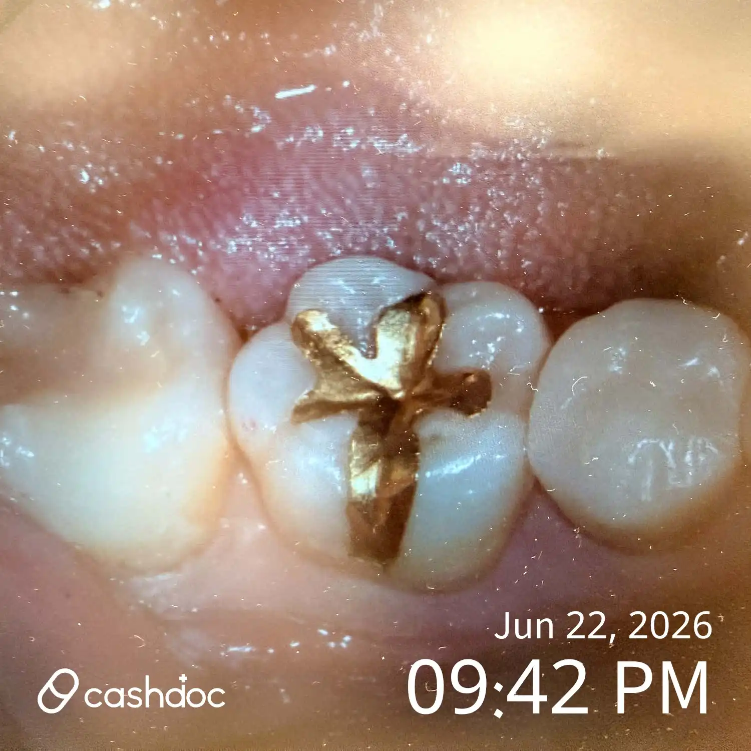 Review photo