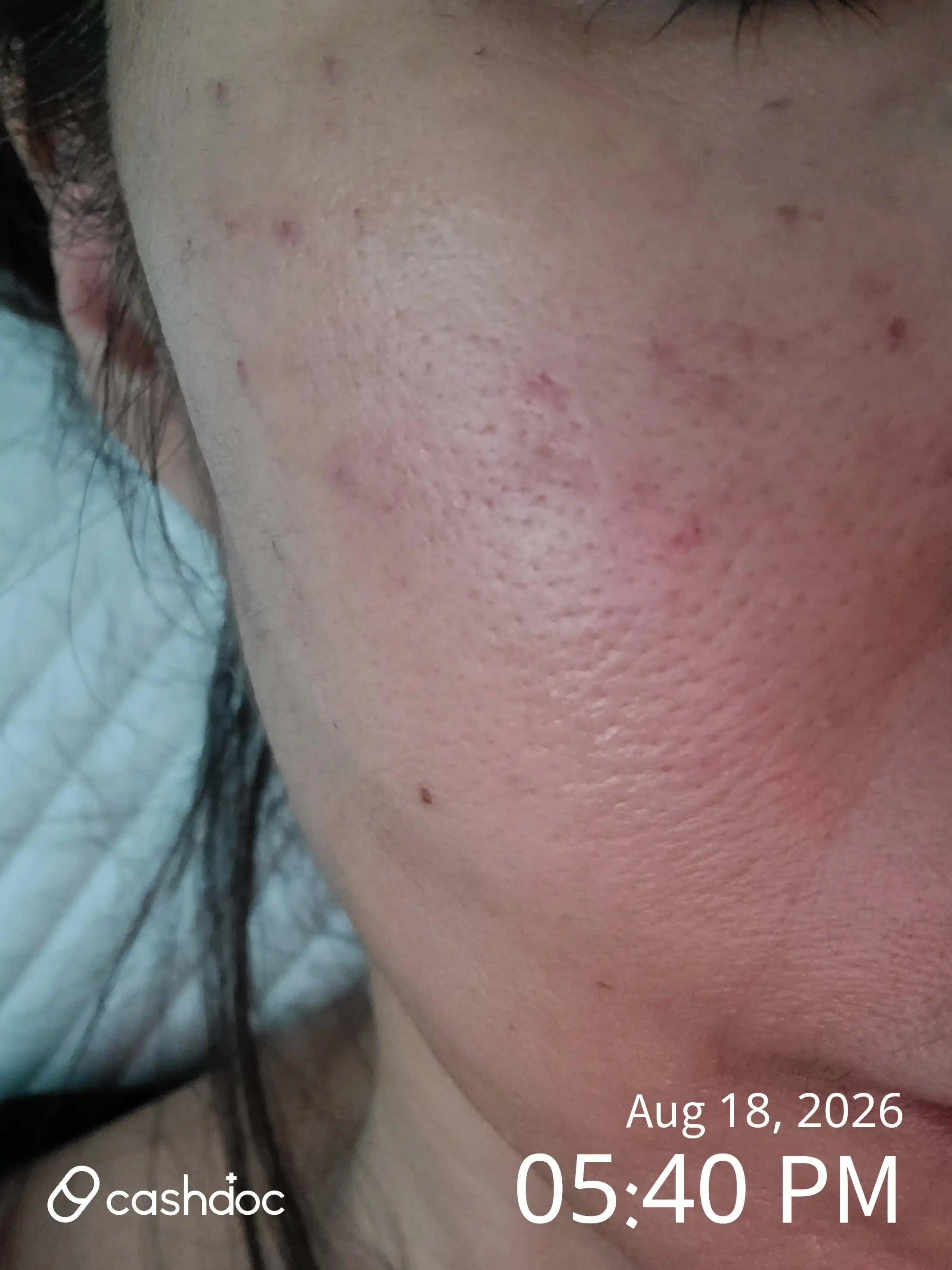 Review photo
