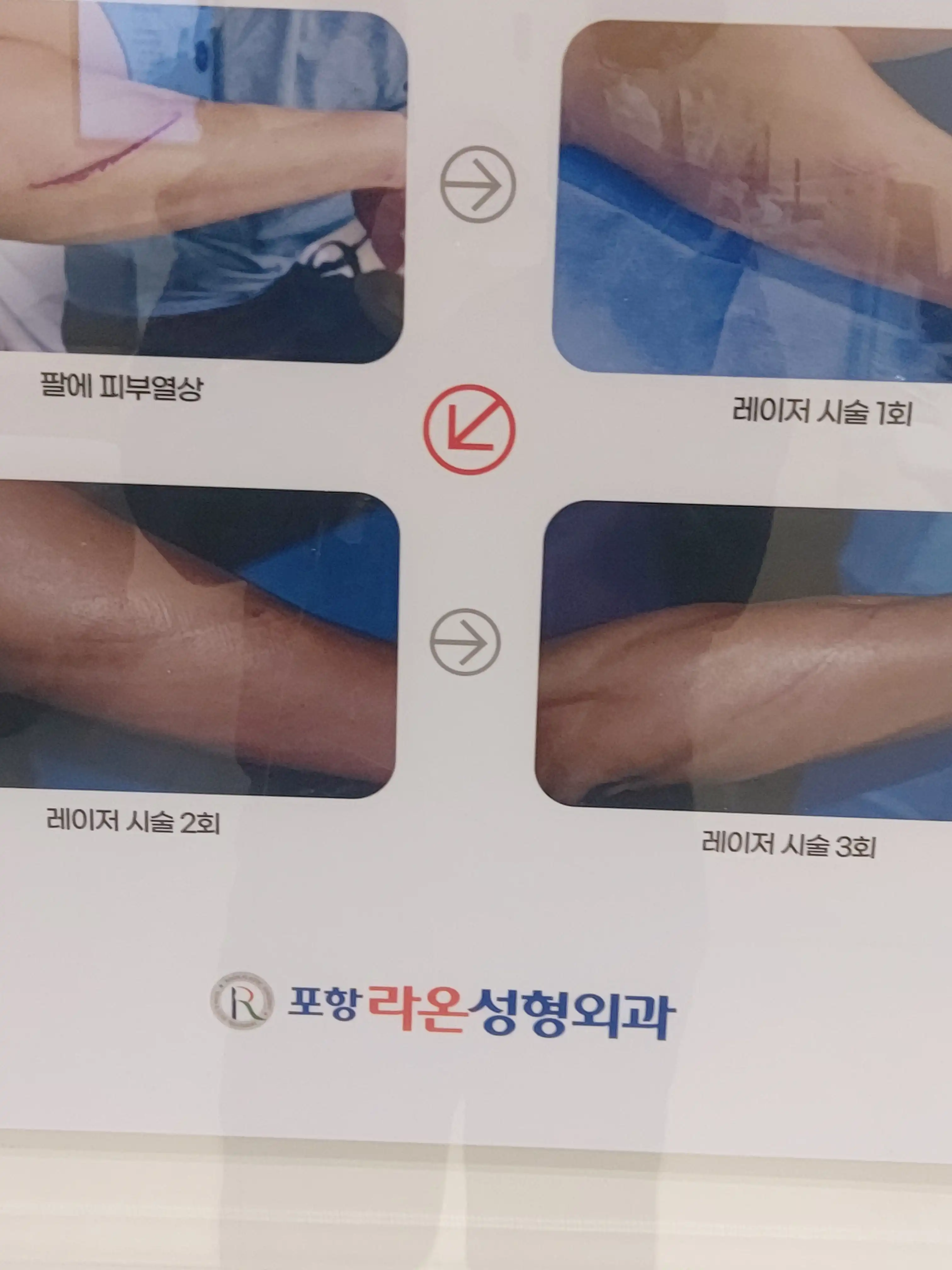 评价照片
