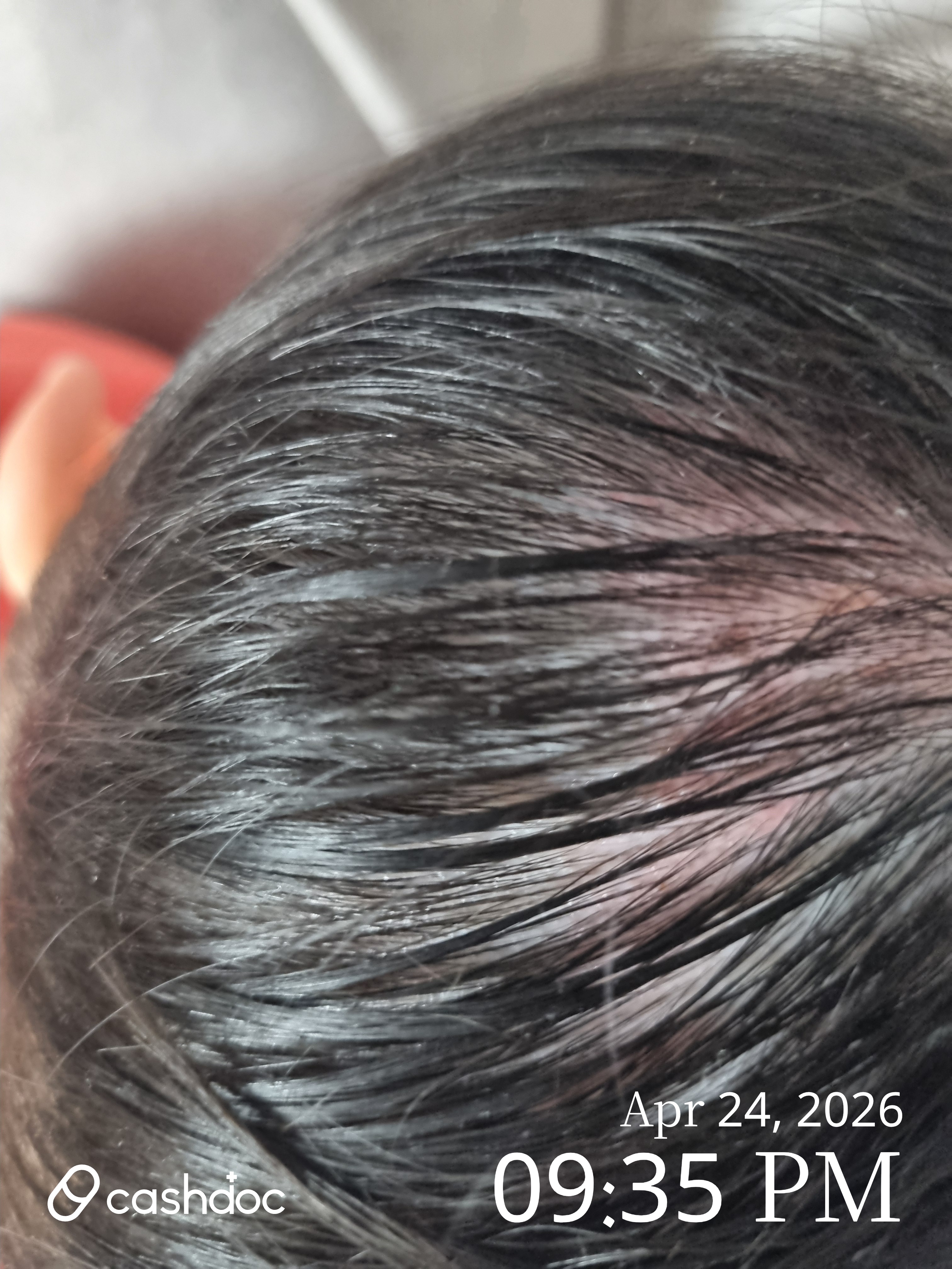 중구 영종센트럴피부과에서 아이 친절 진료 받았어요