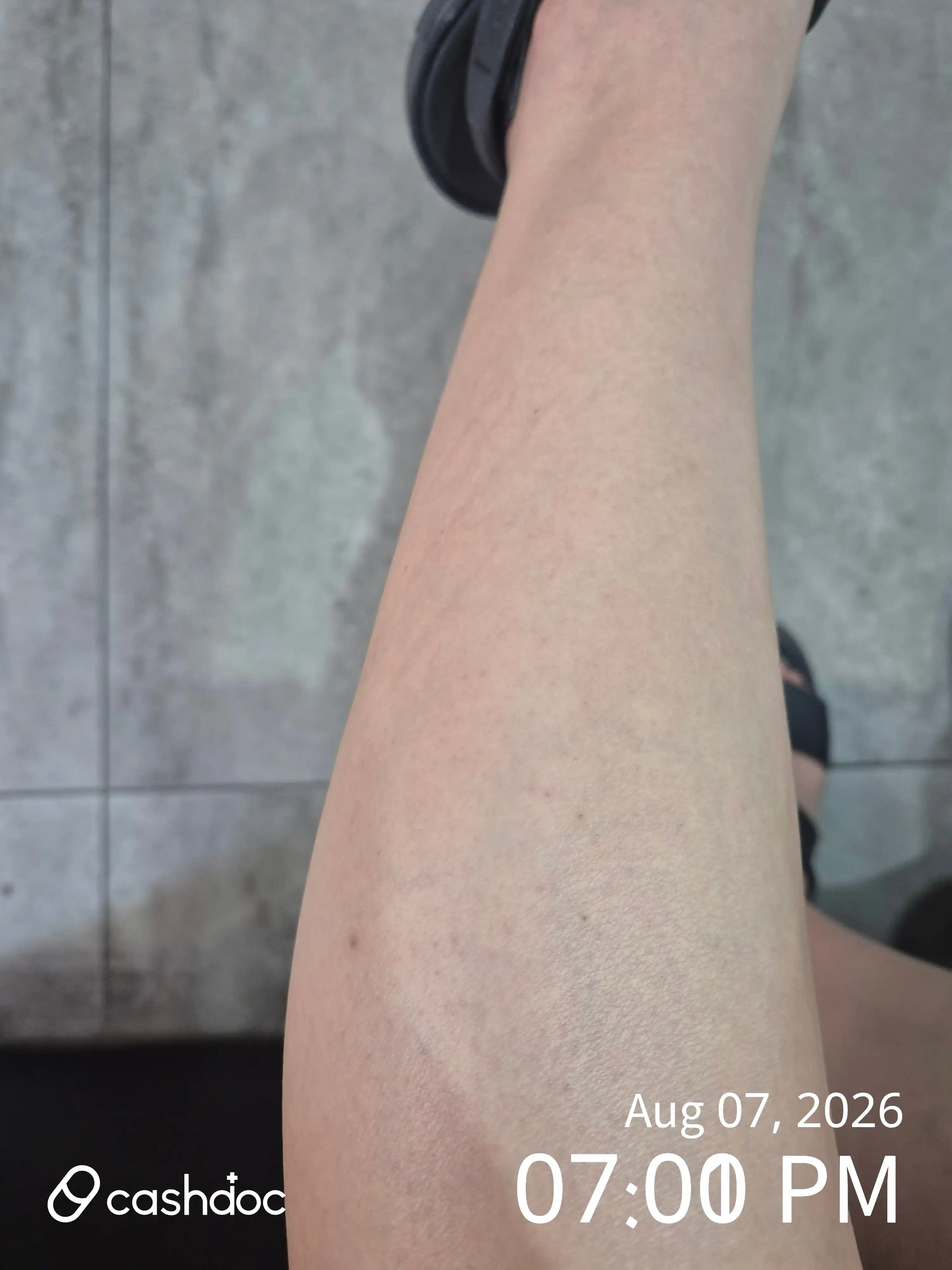 Review photo