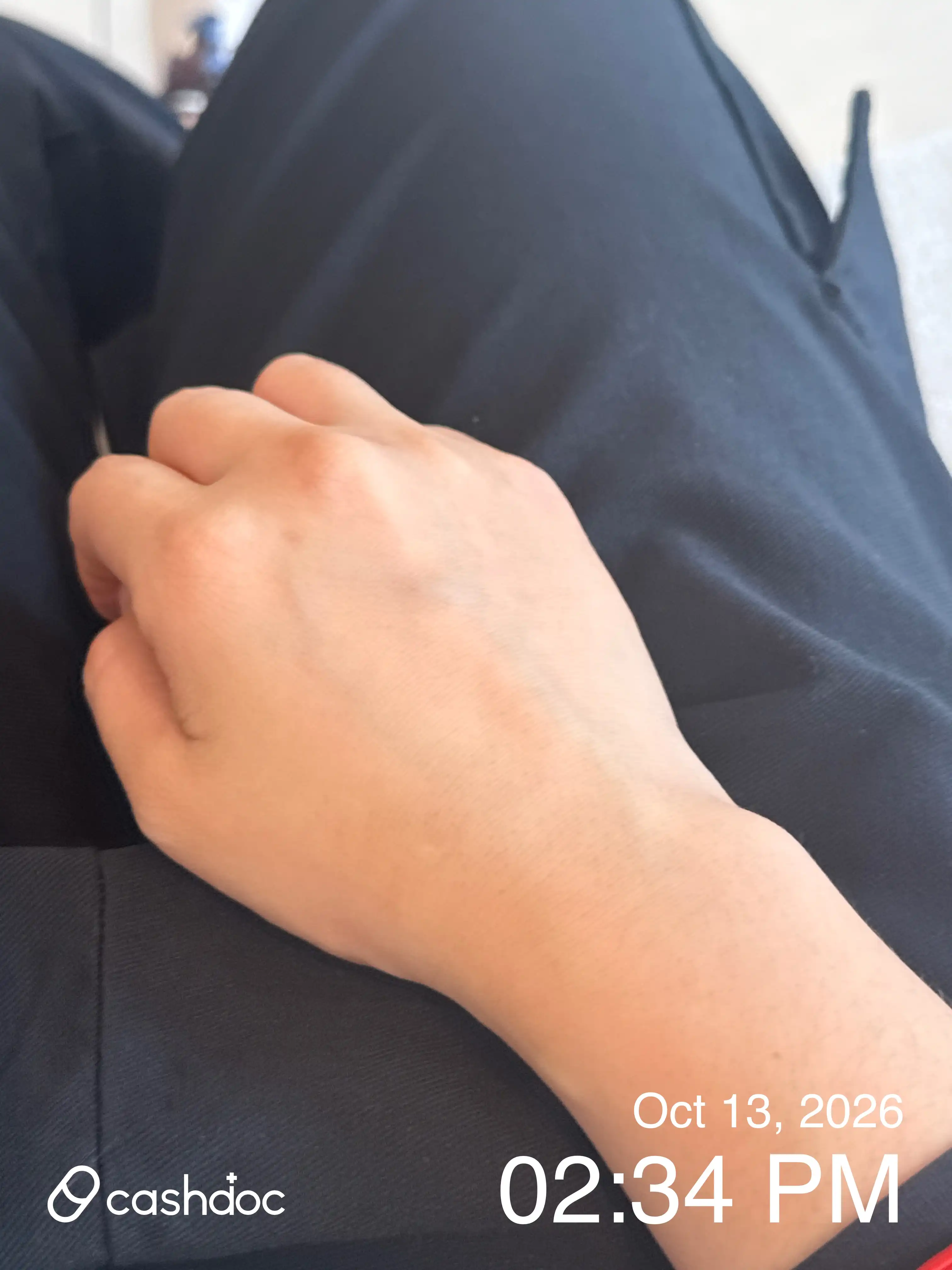미사일마취통증의학과의원 후기 사진
