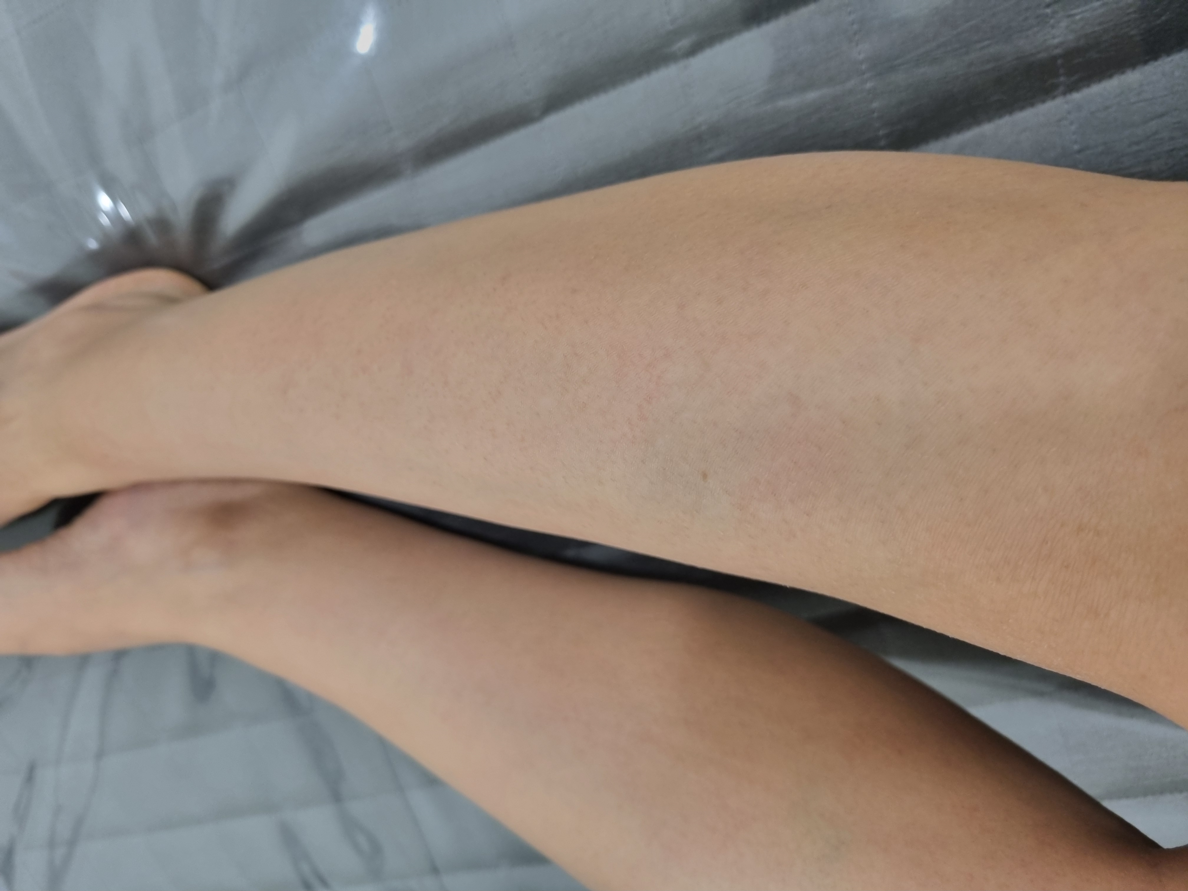 부평구 유앤아이의원에서 종아리제모 편리하고 만족스럽게 받아요