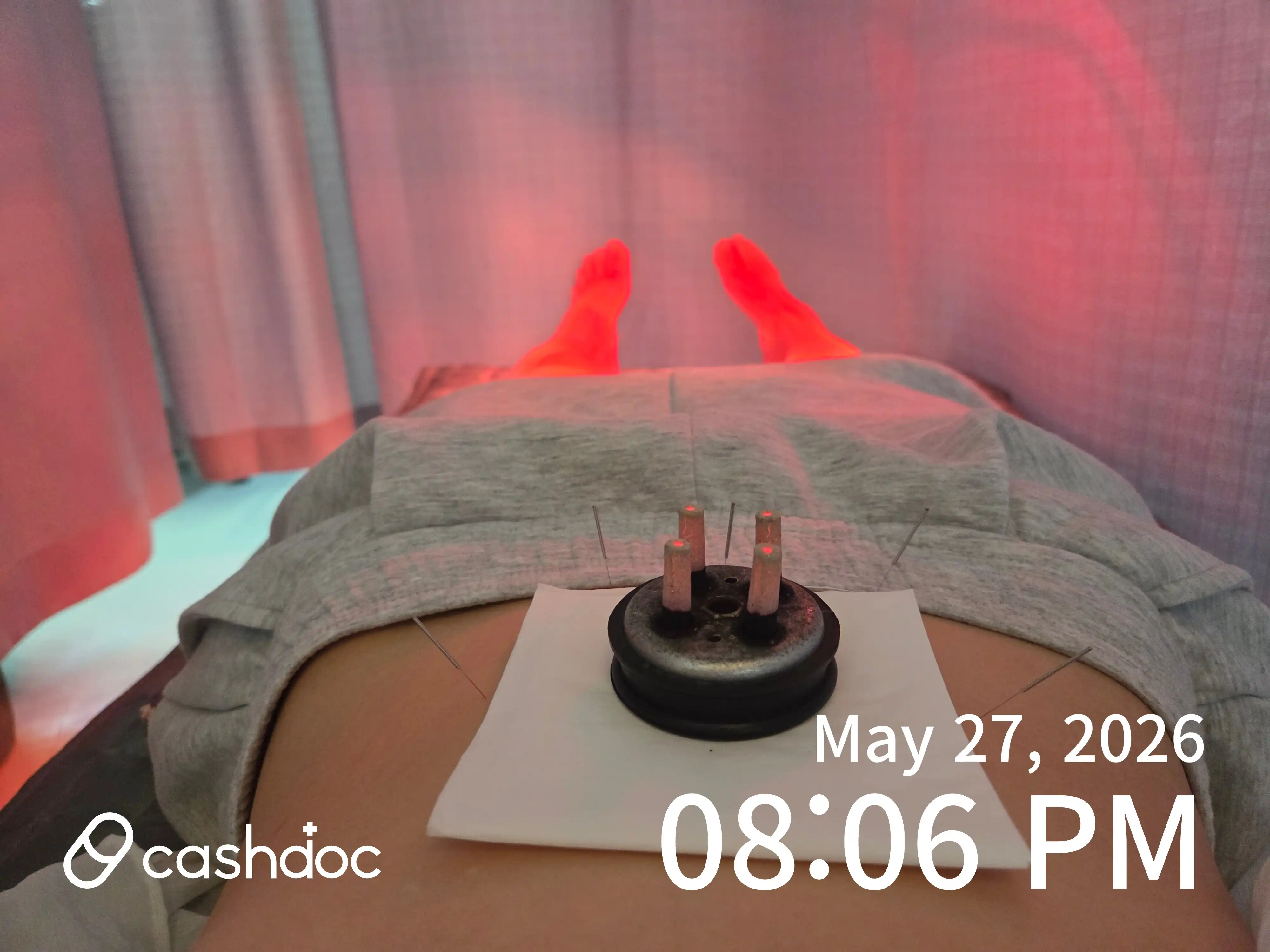 Review photo