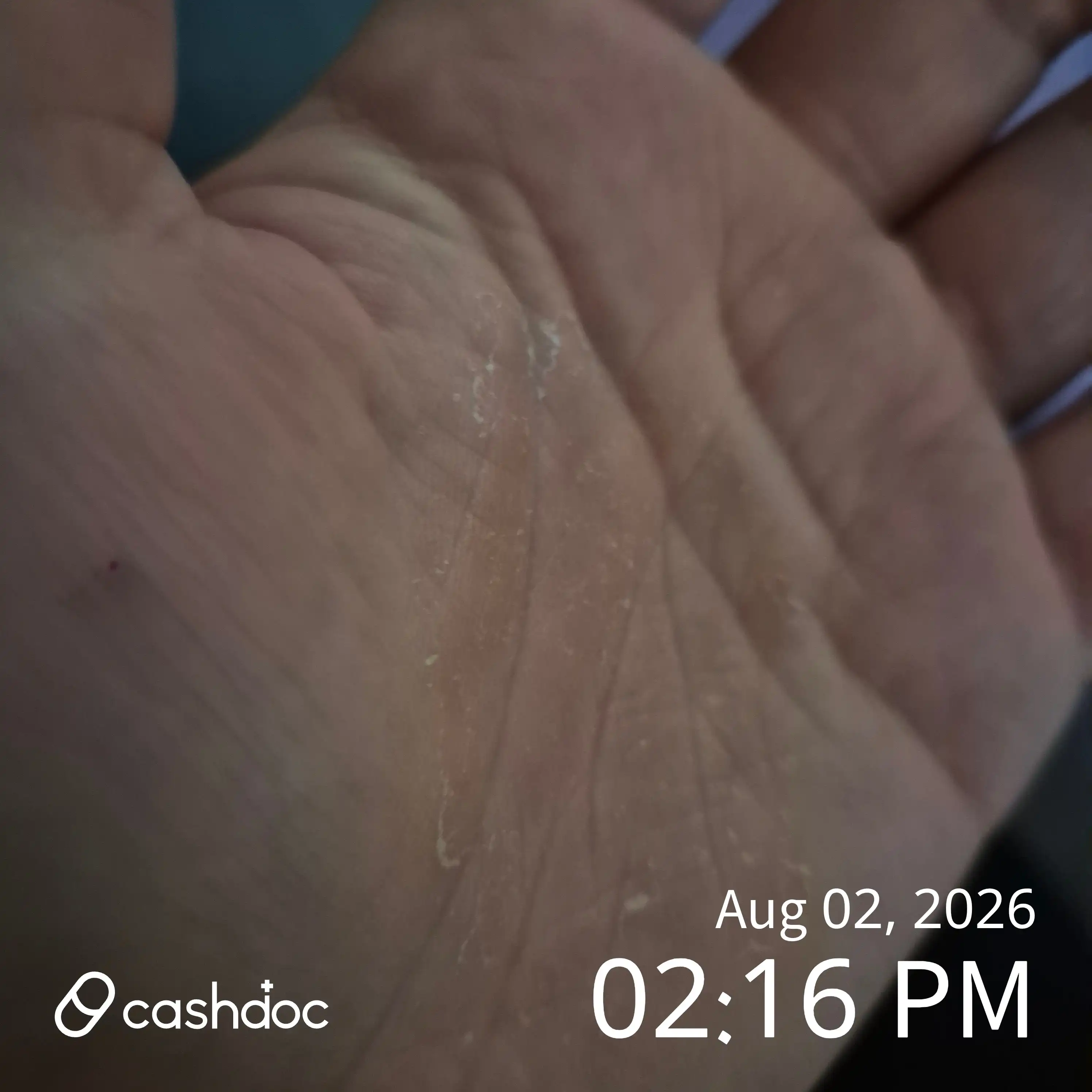 Review photo