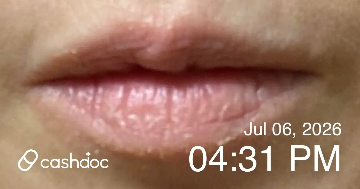 评价照片