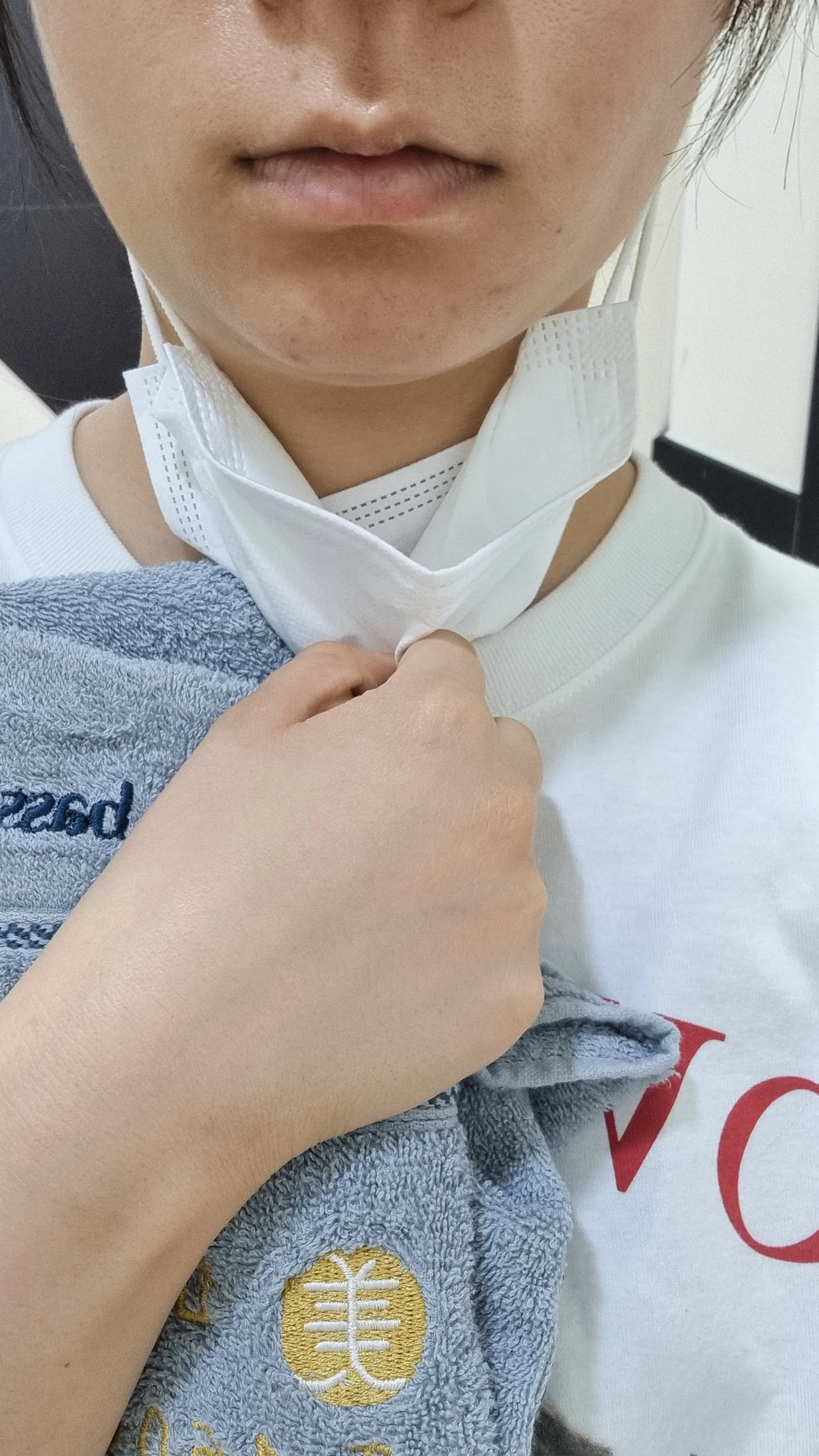 시술 전 — 미케이 피부 탄력개선_슈링크 300샷