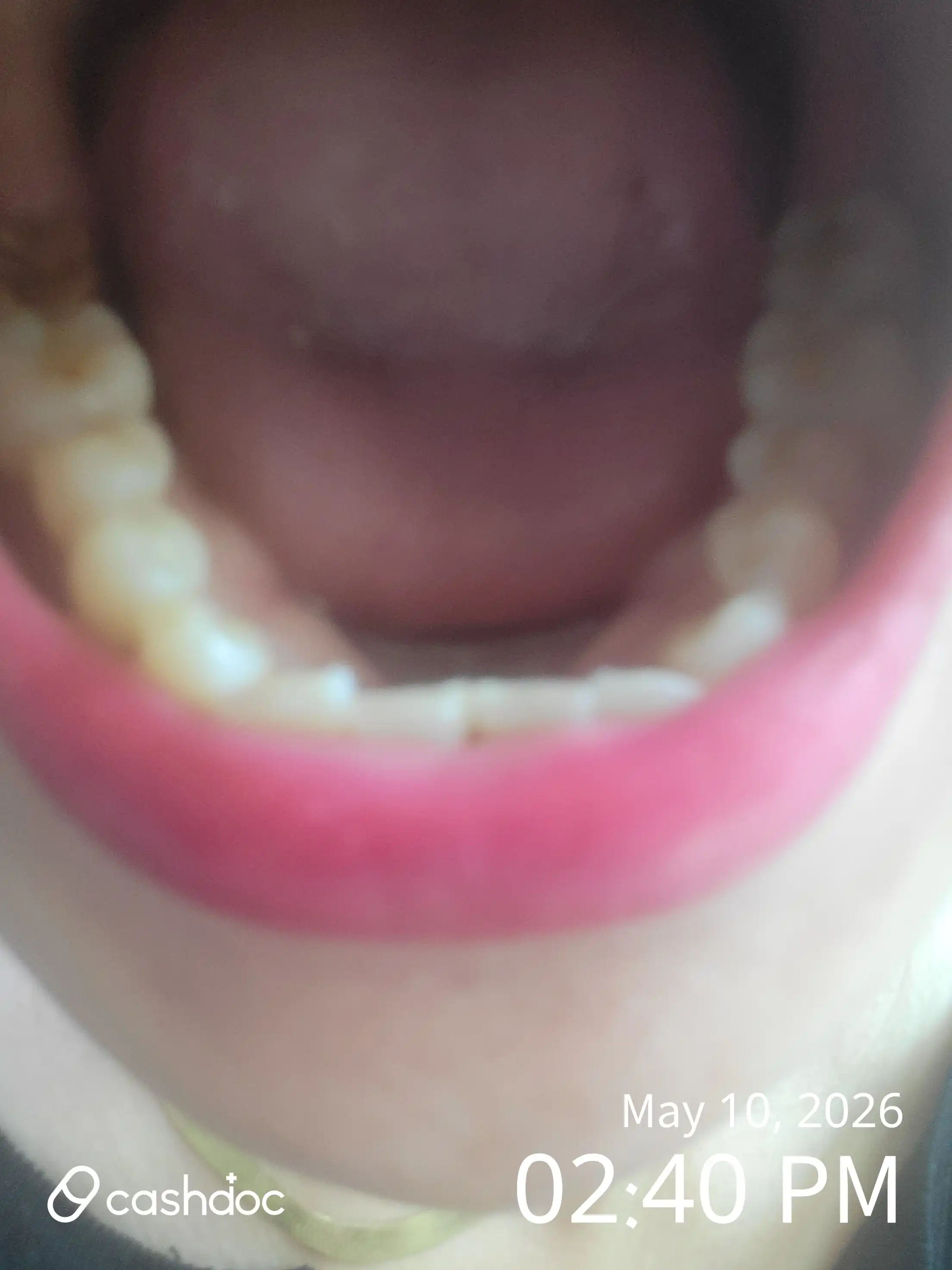 Review photo