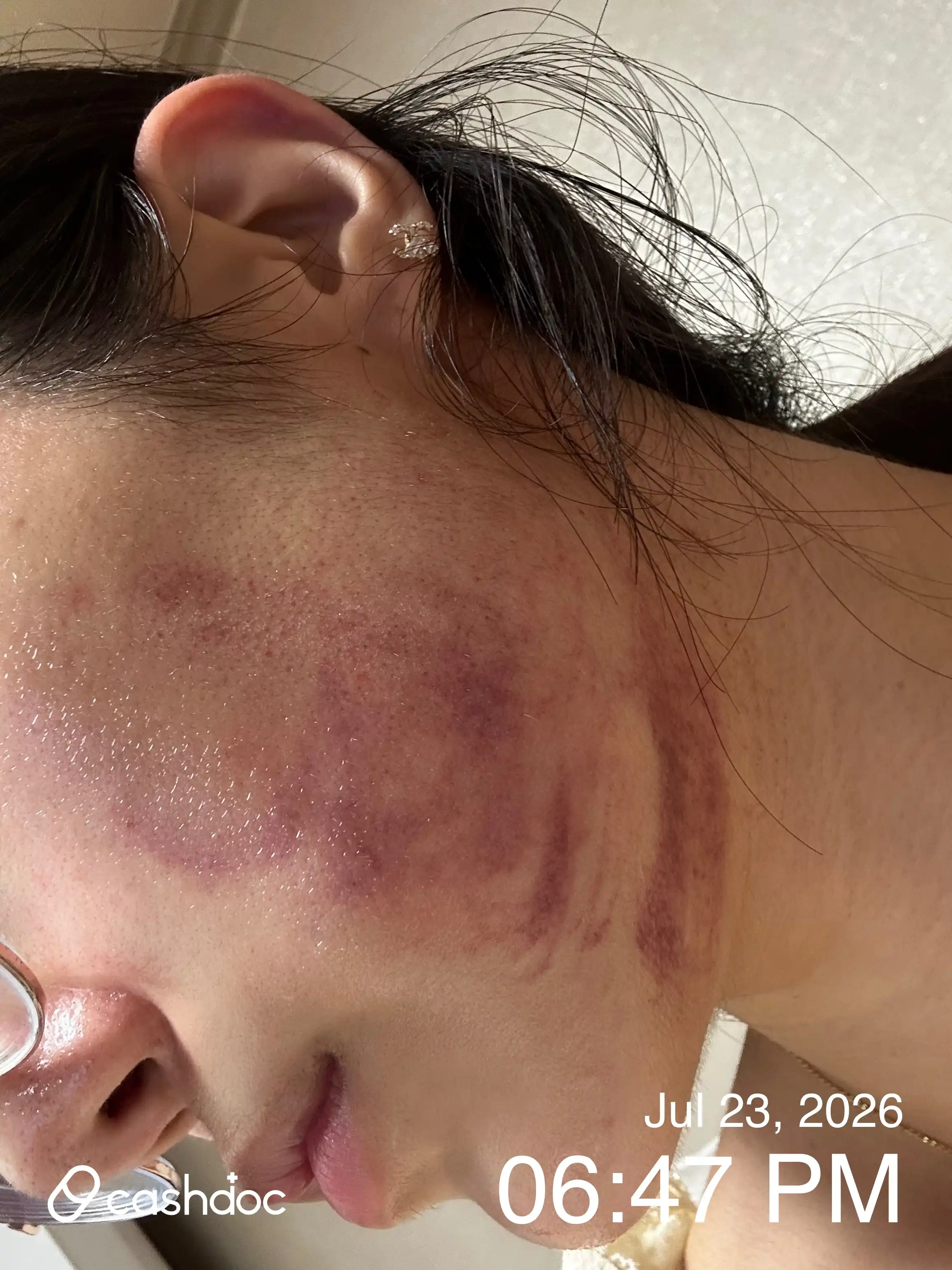 评价照片