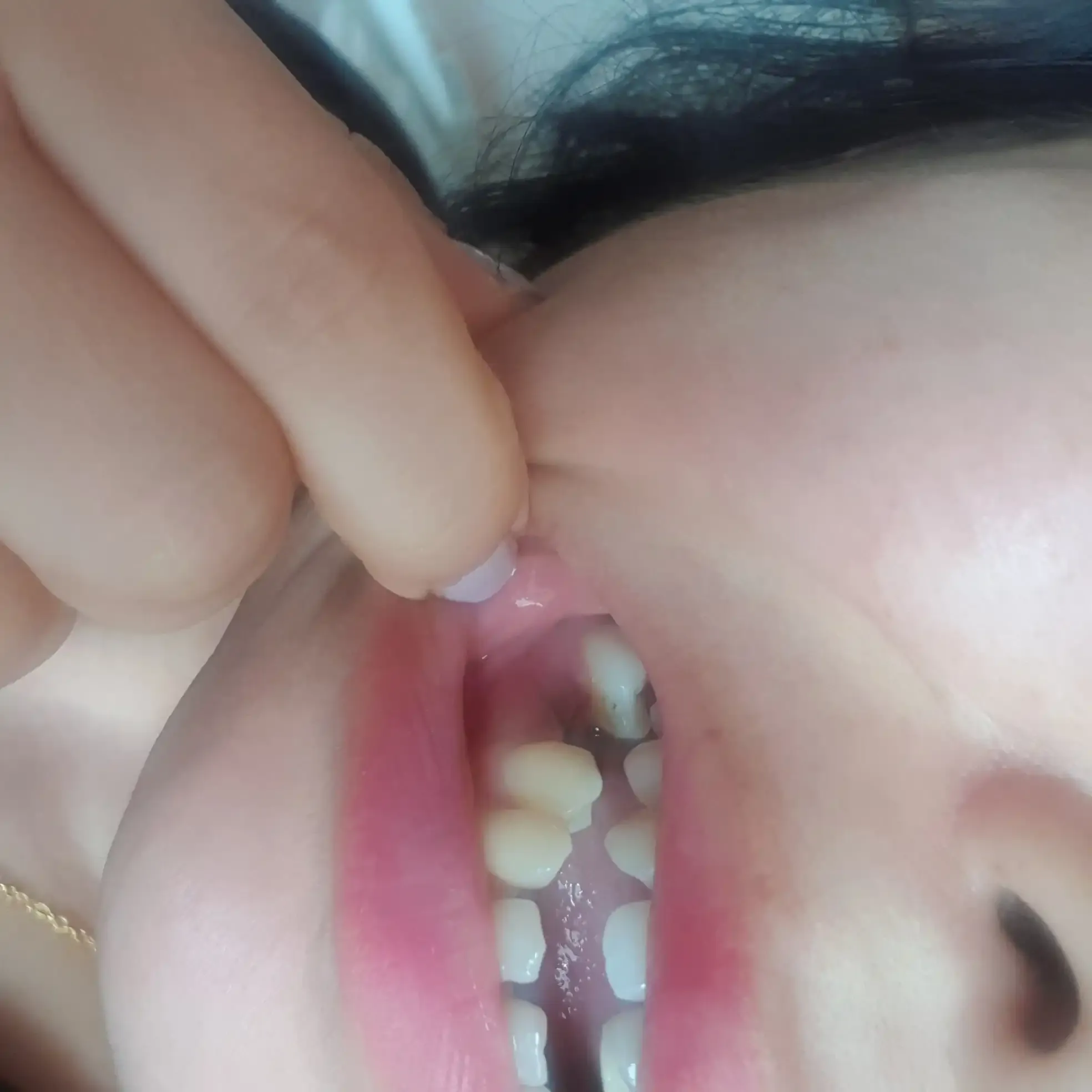 术前照片