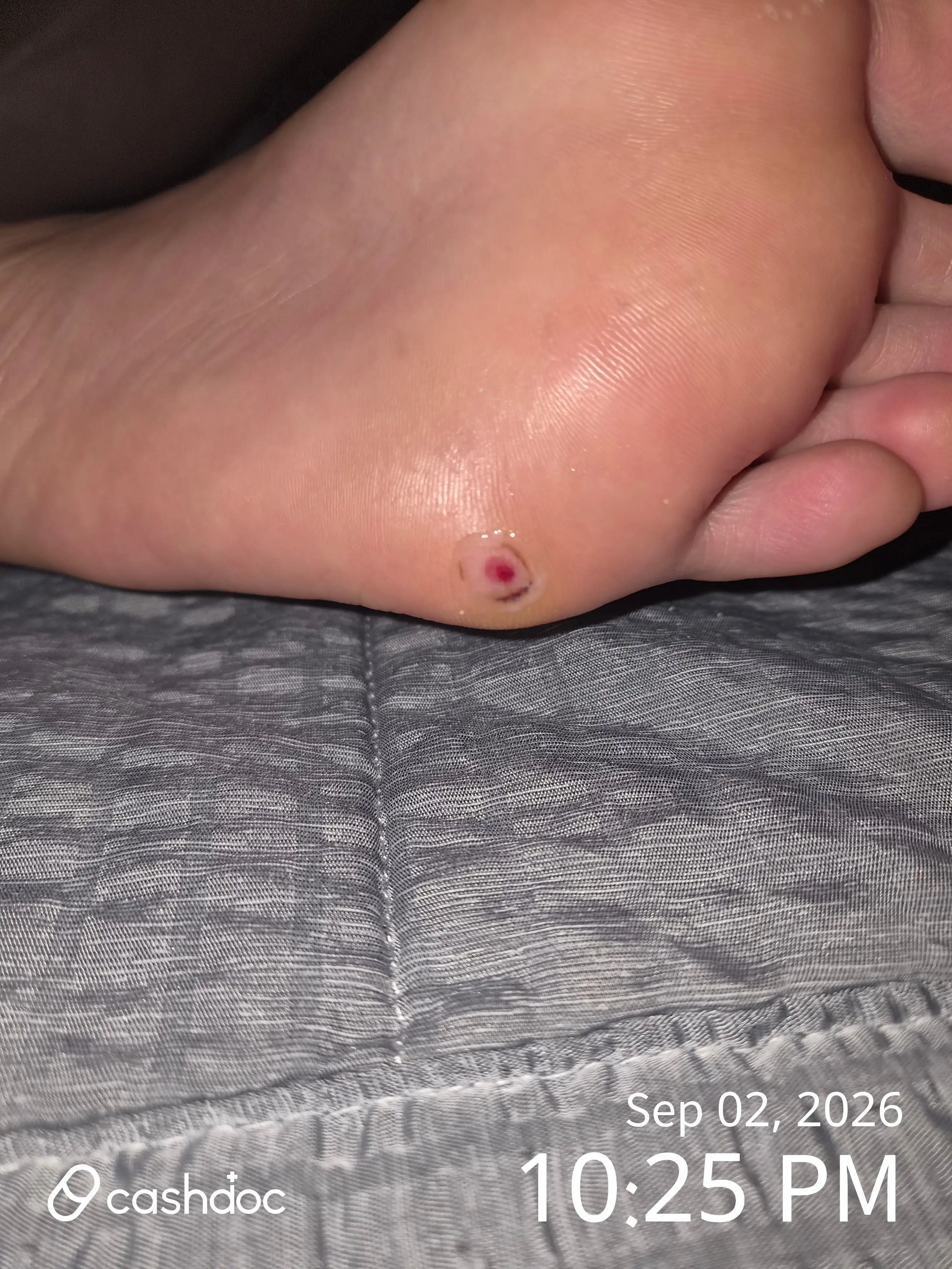 评价照片