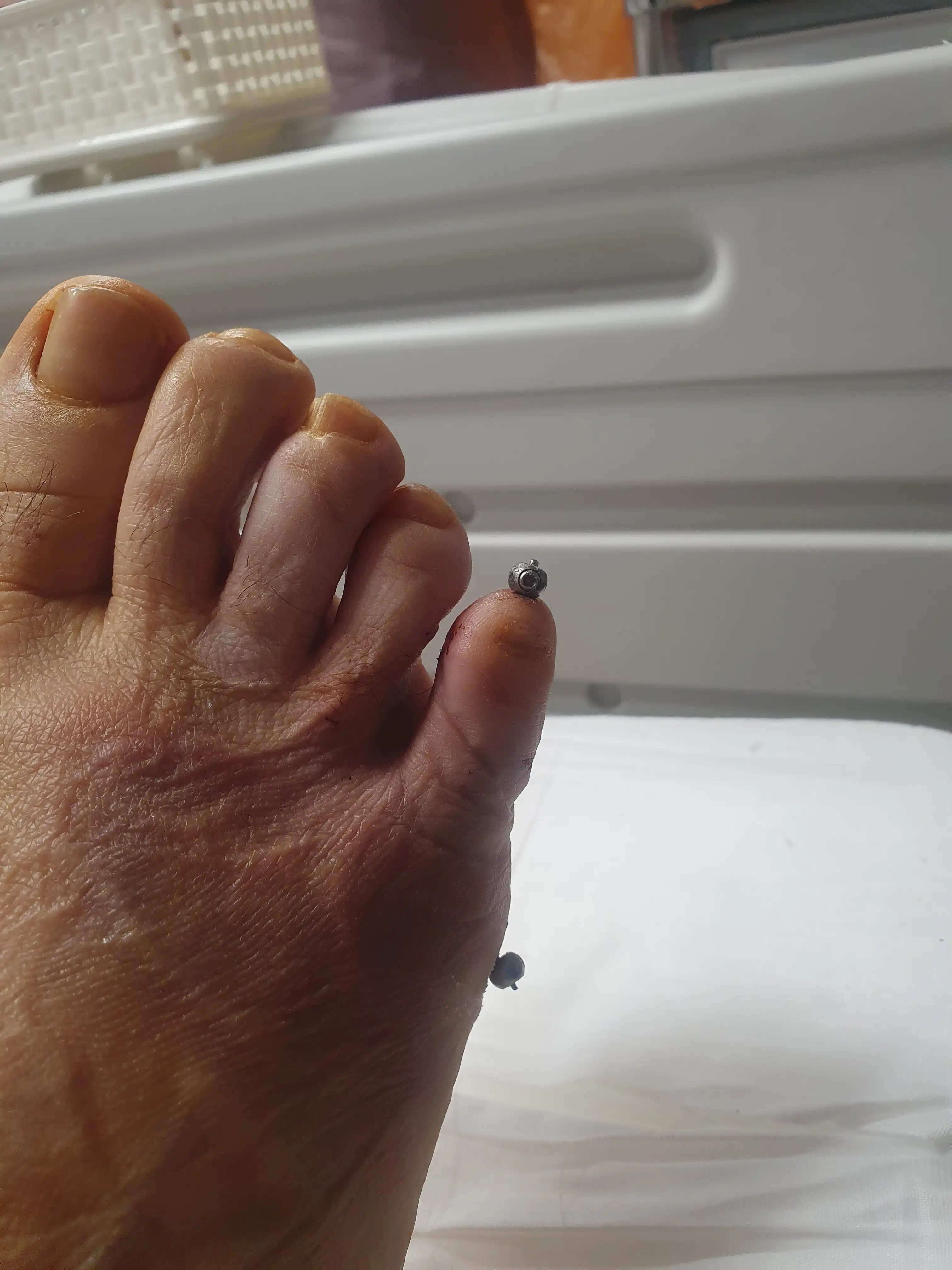 评价照片