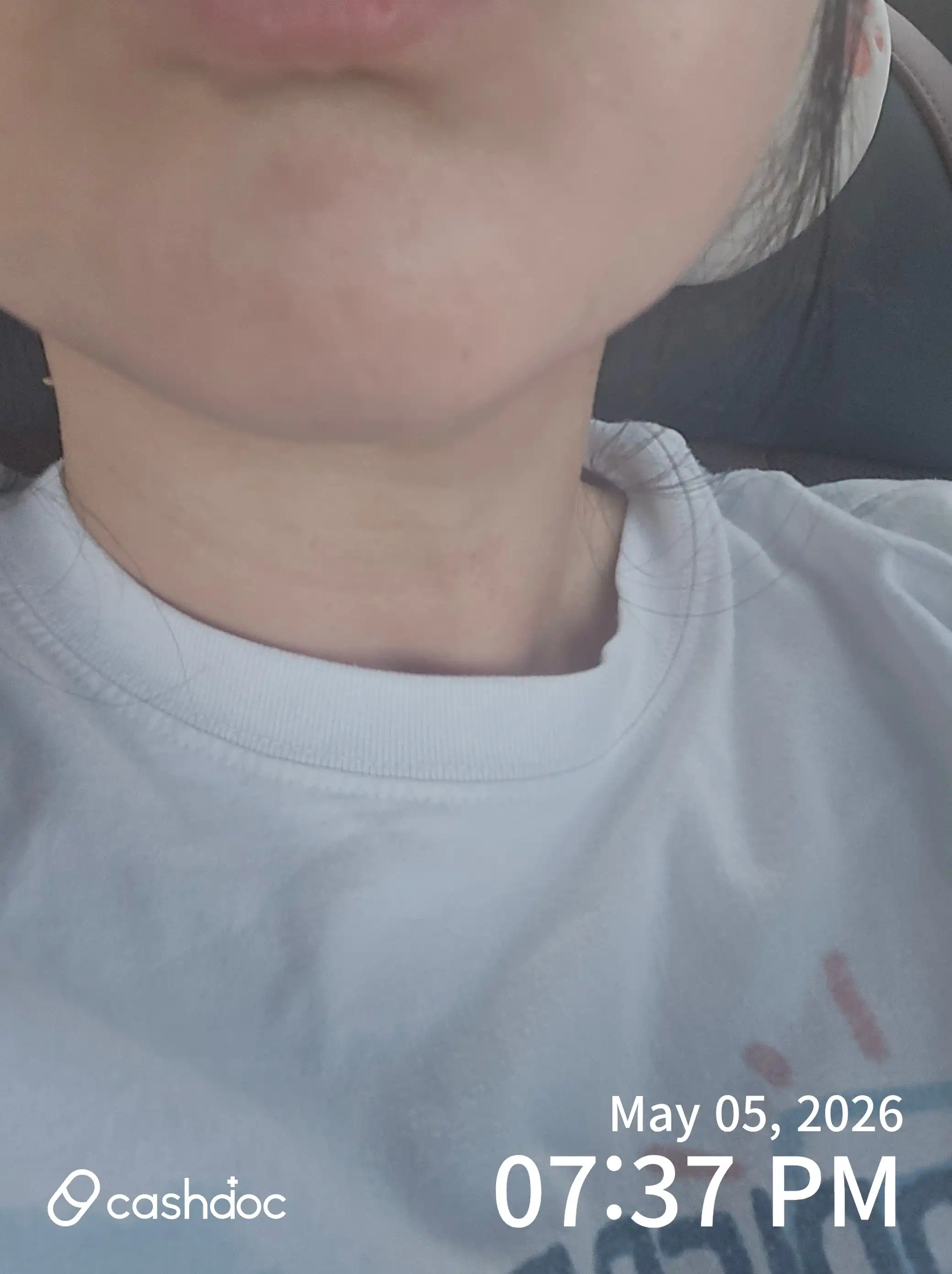 Review photo