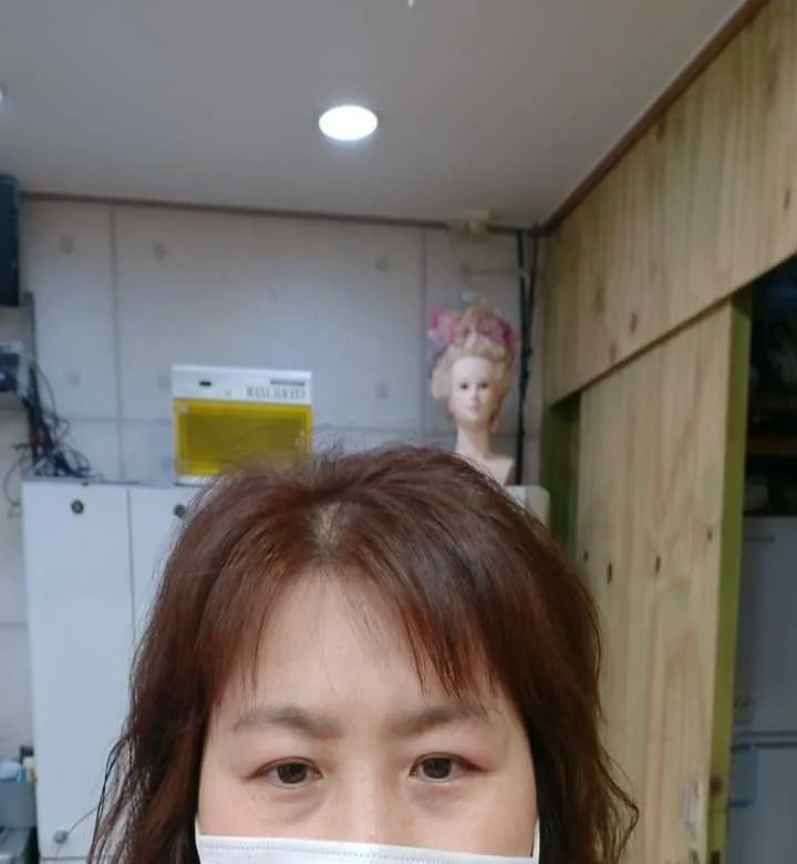 시술 전 — 	번지지않는 아이라인반영구	