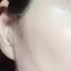 後