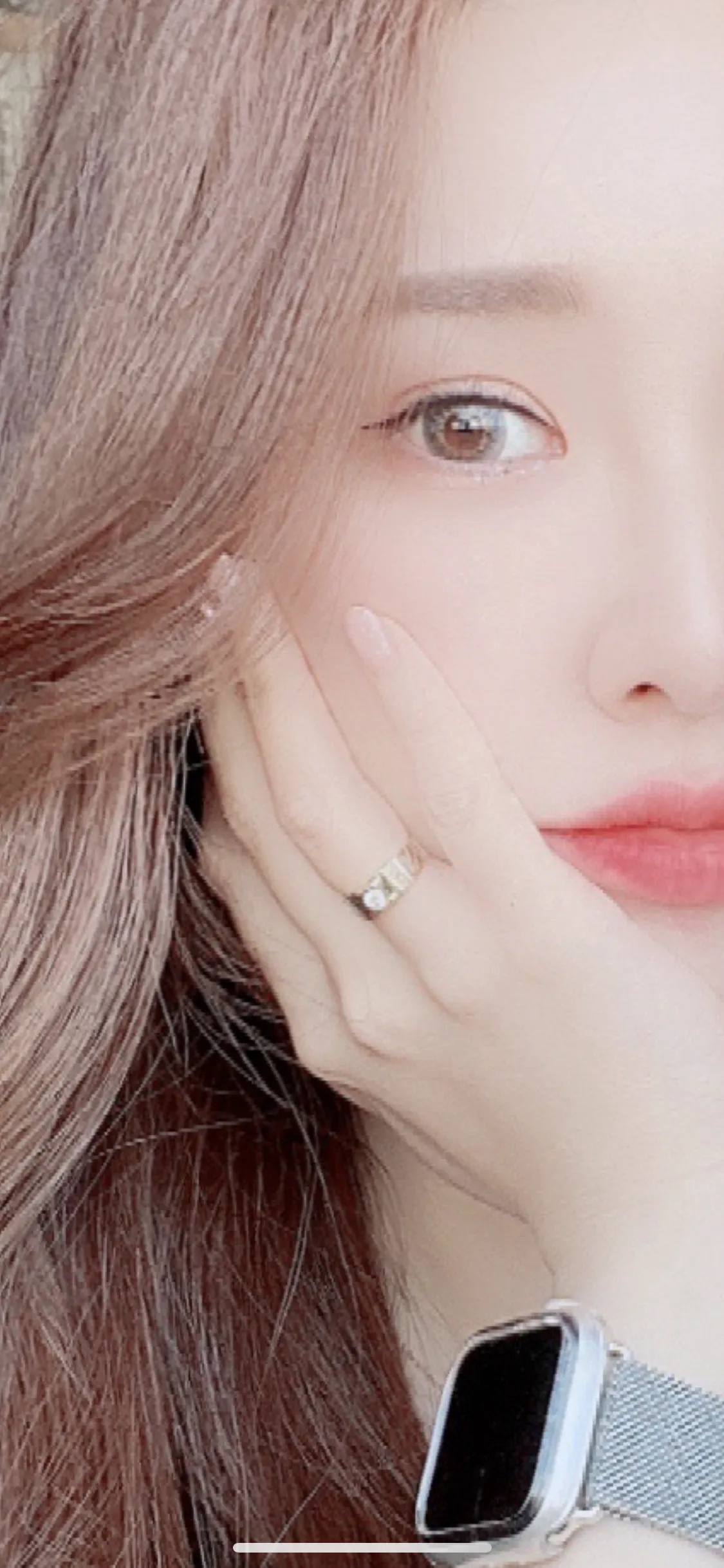 시술 후 — 싸이토케어 (에르메스주사)