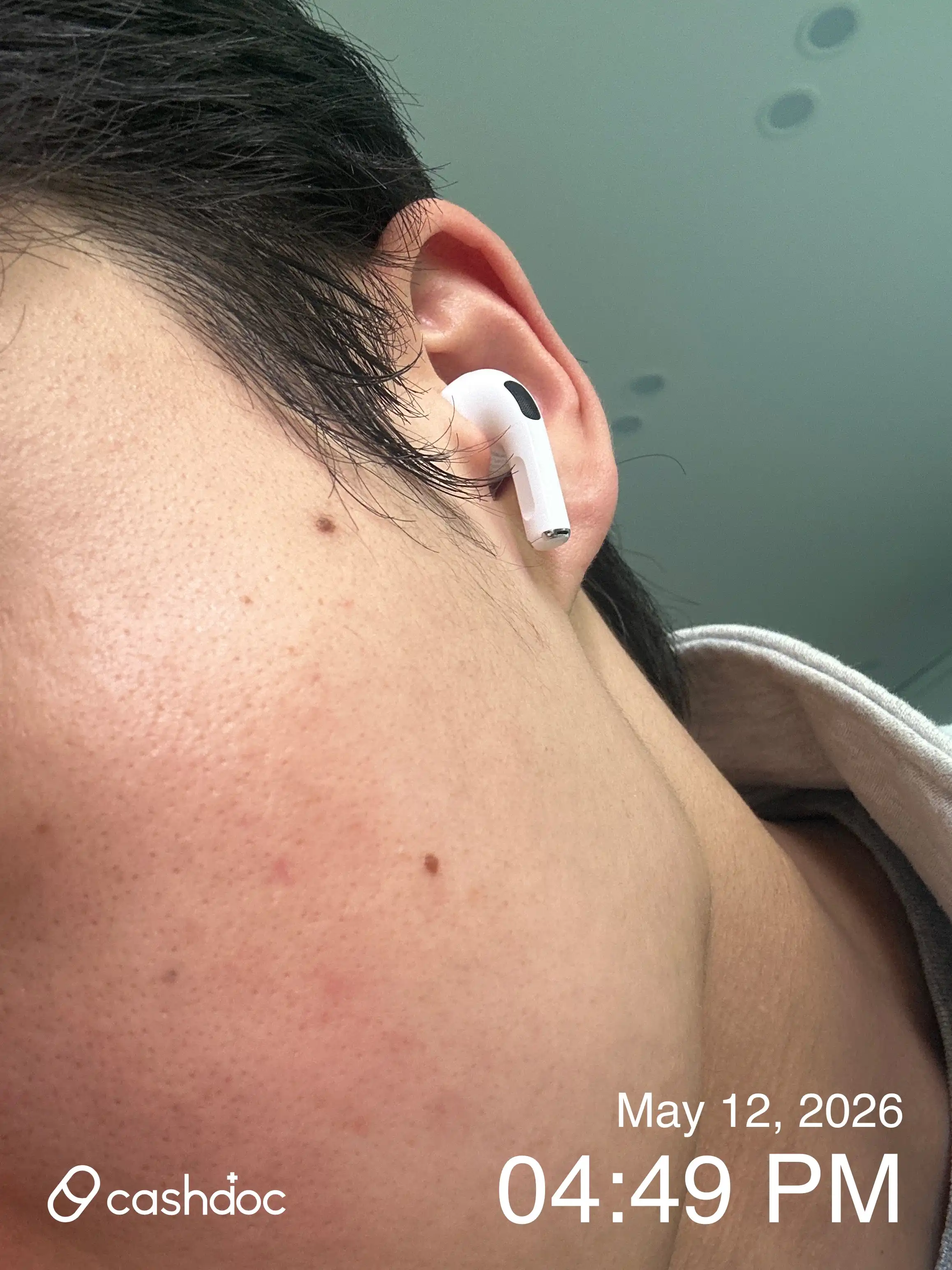 Review photo