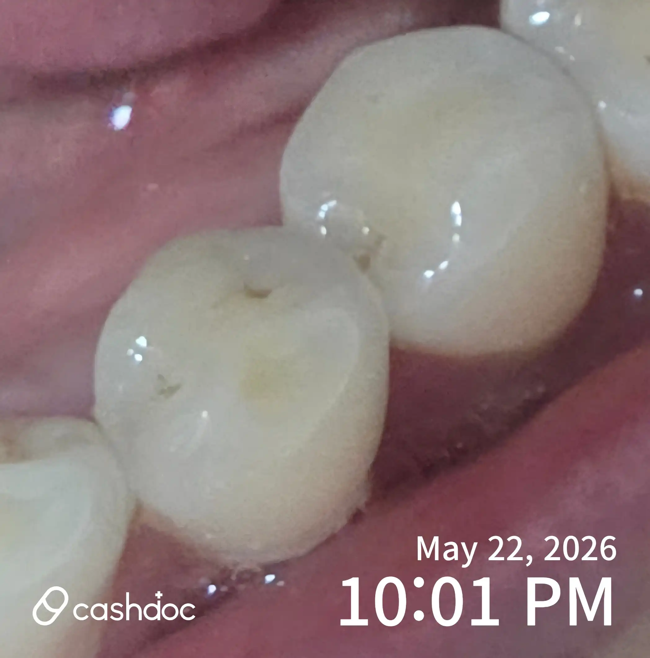 评价照片