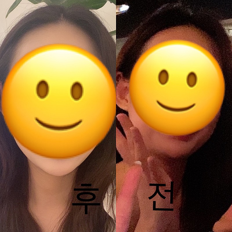 后