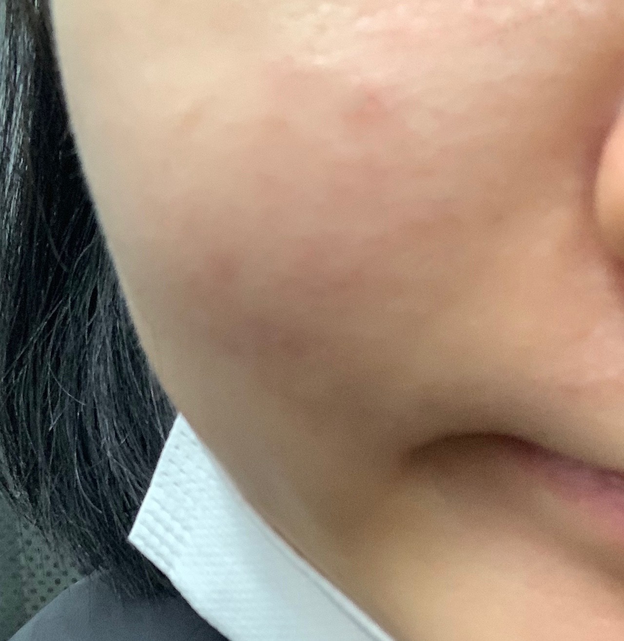 後