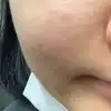 後
