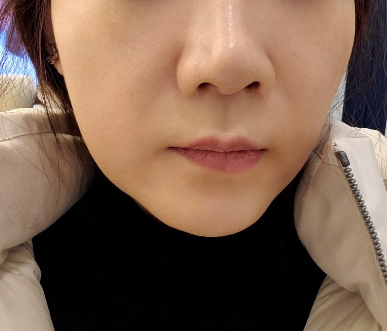 评价照片
