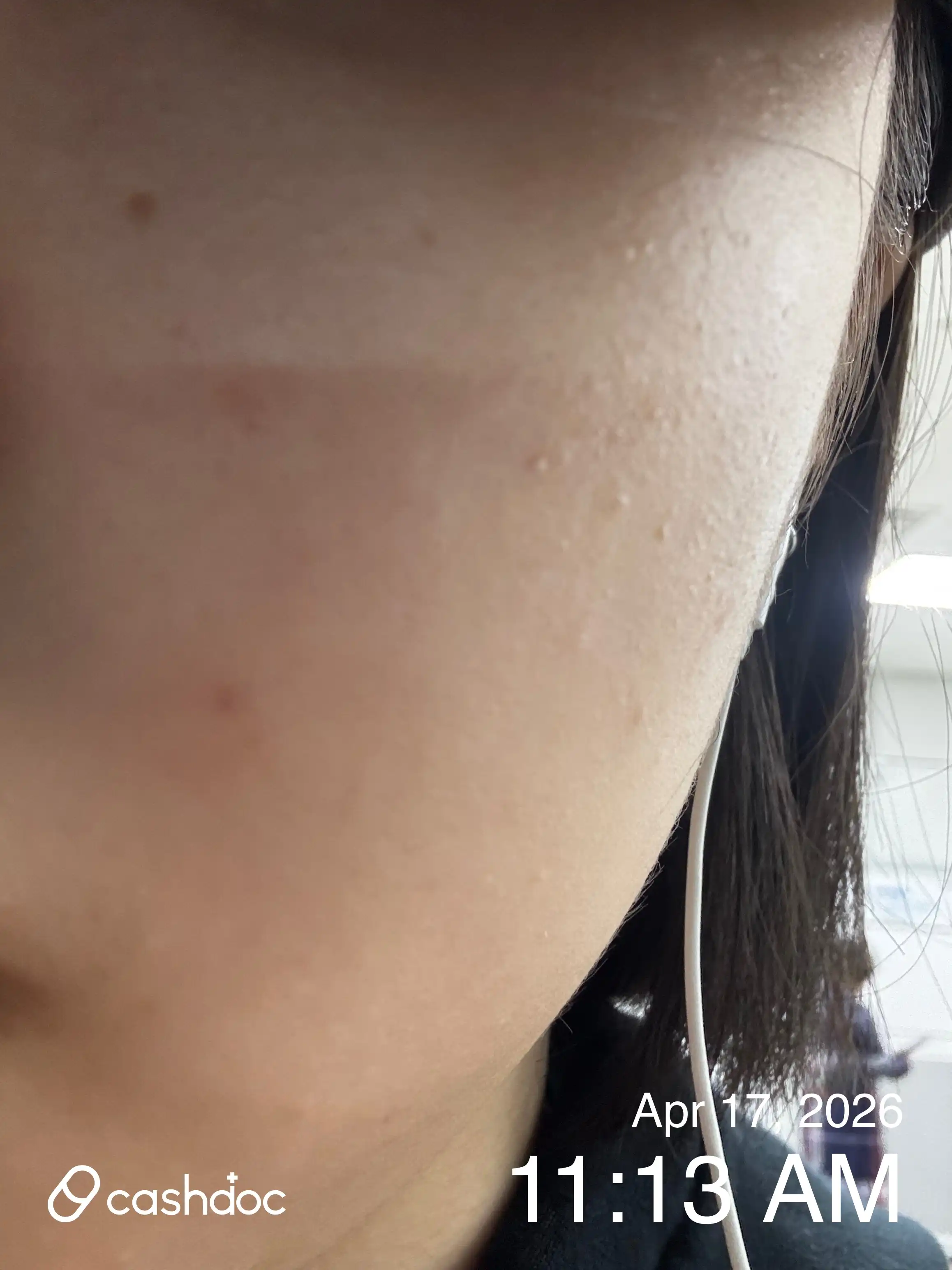 Review photo