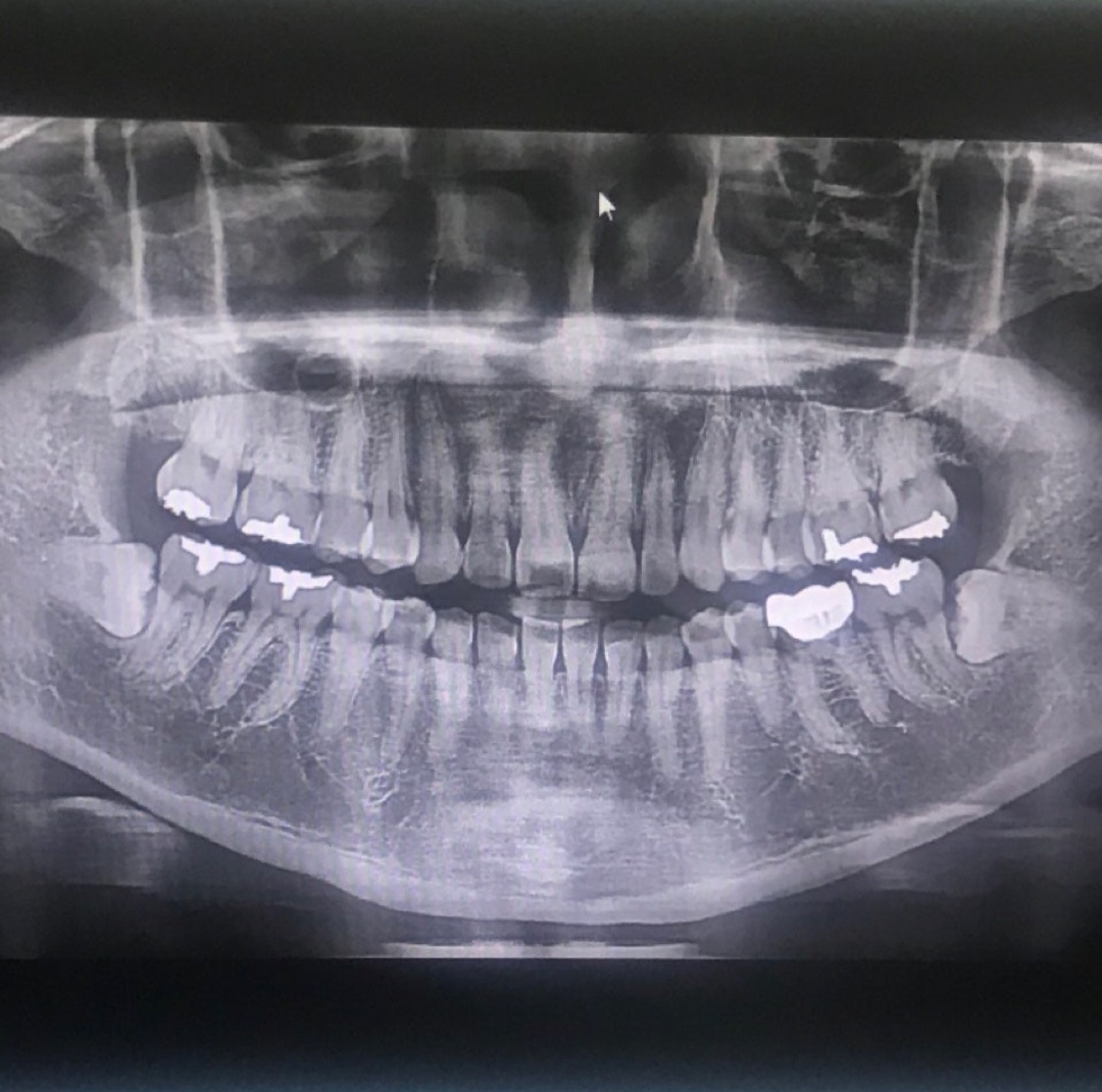 서울솔치과의원, 스켈링 공포 없애주는 치과