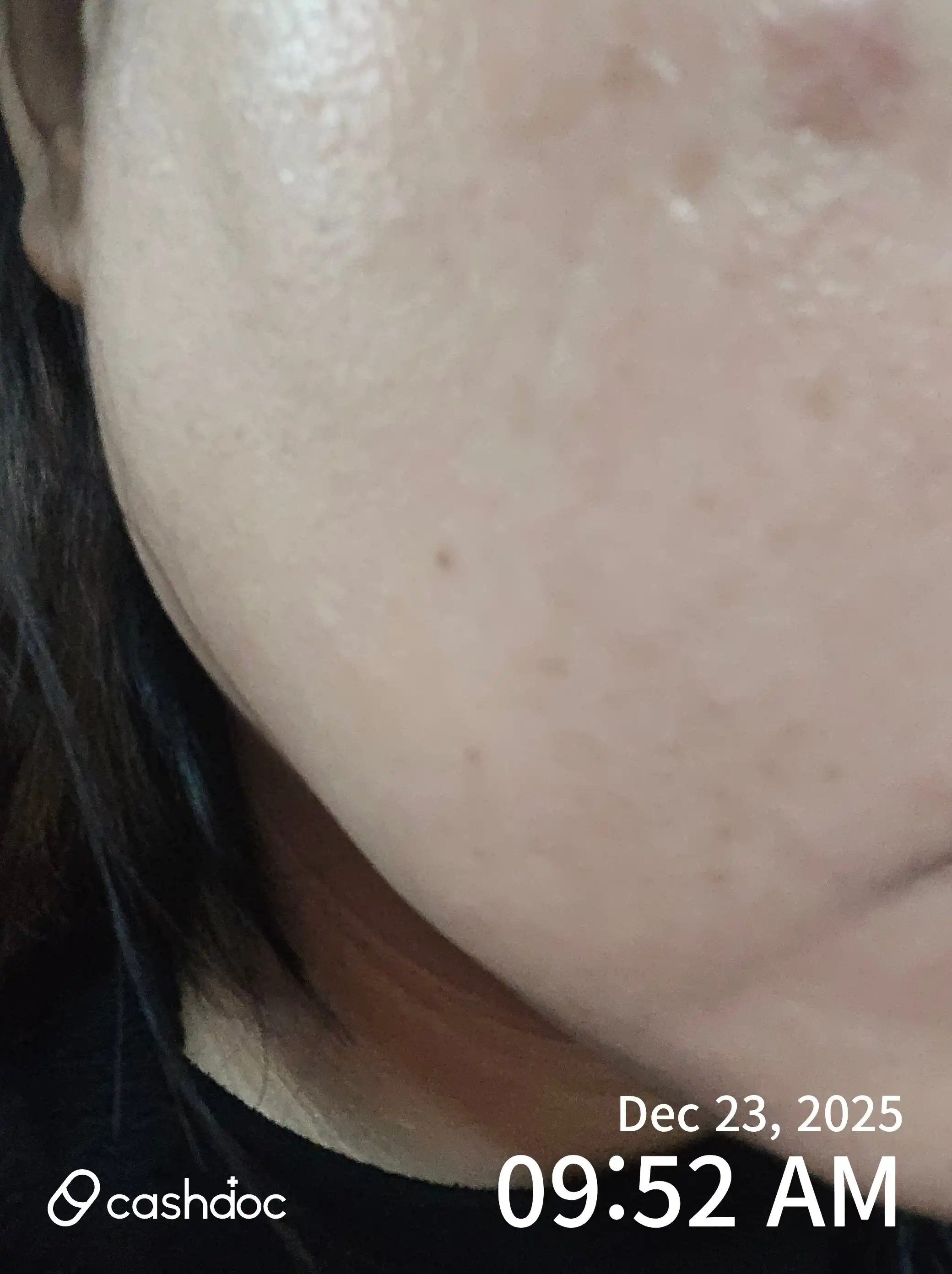 评价照片