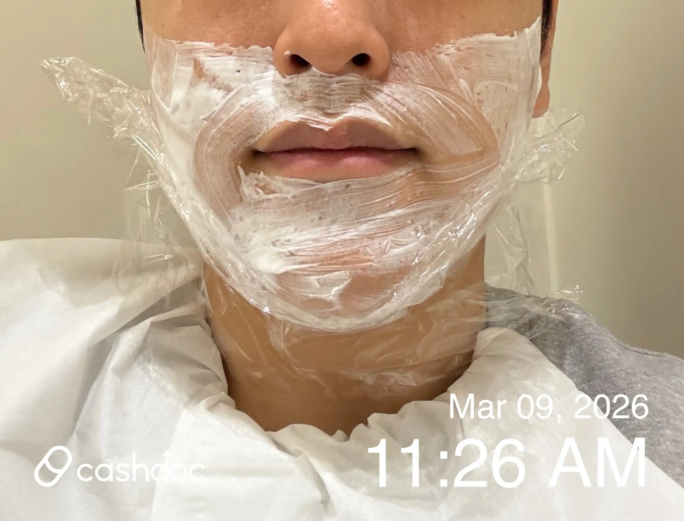 Review photo