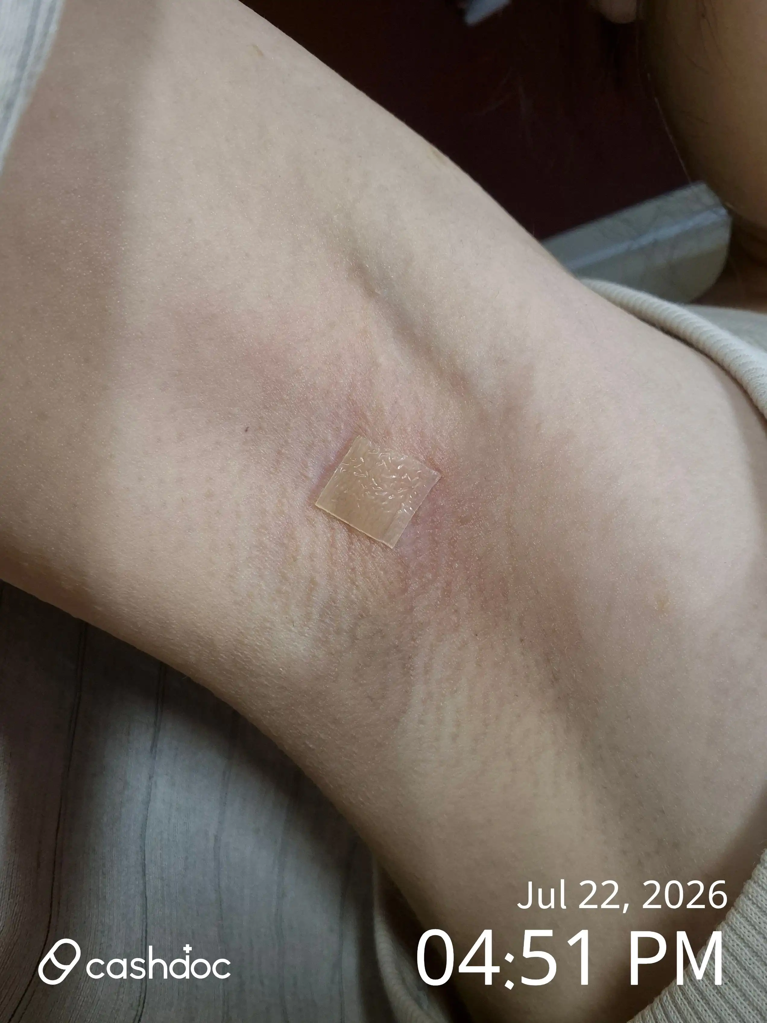 评价照片