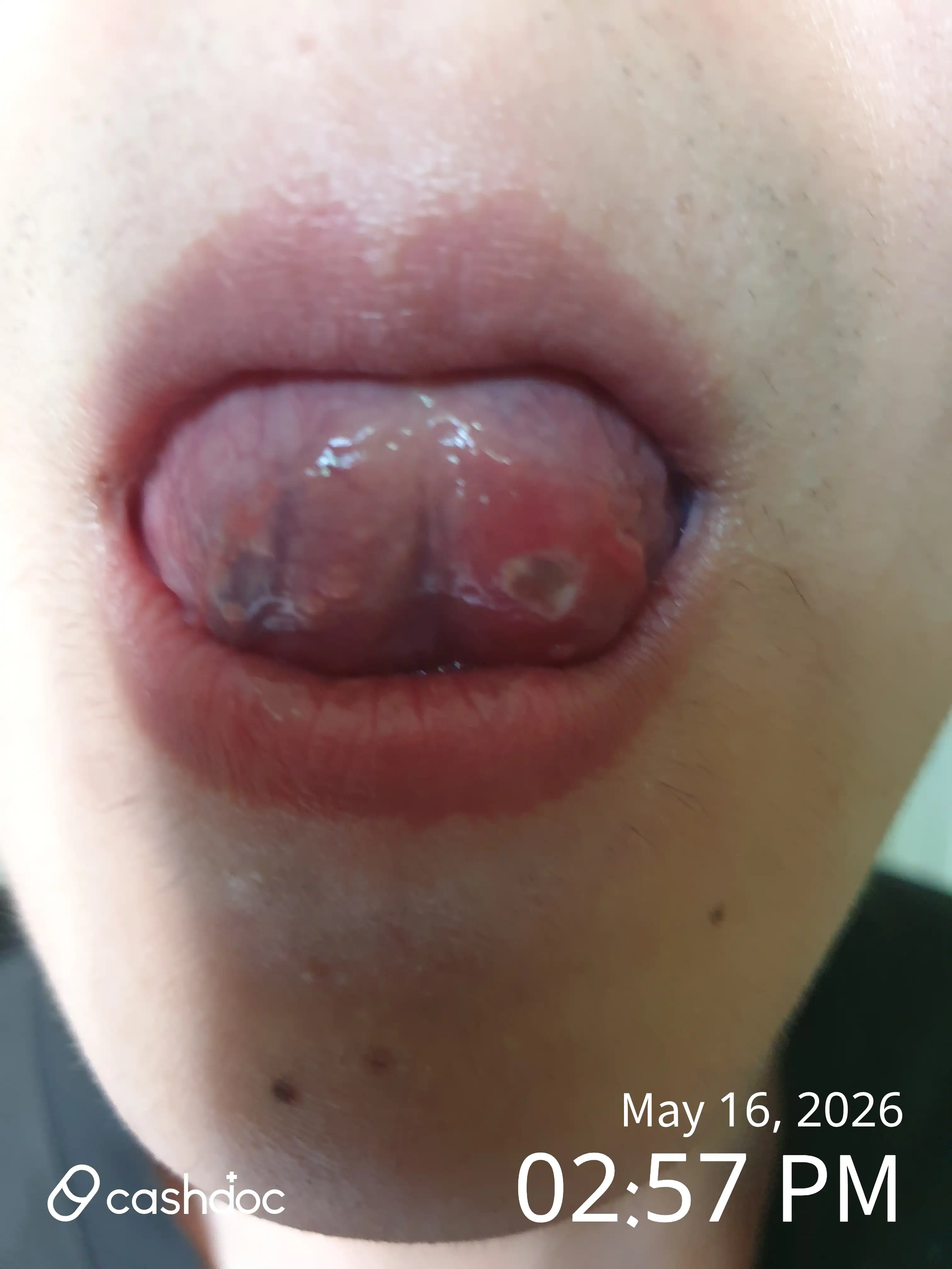 Review photo
