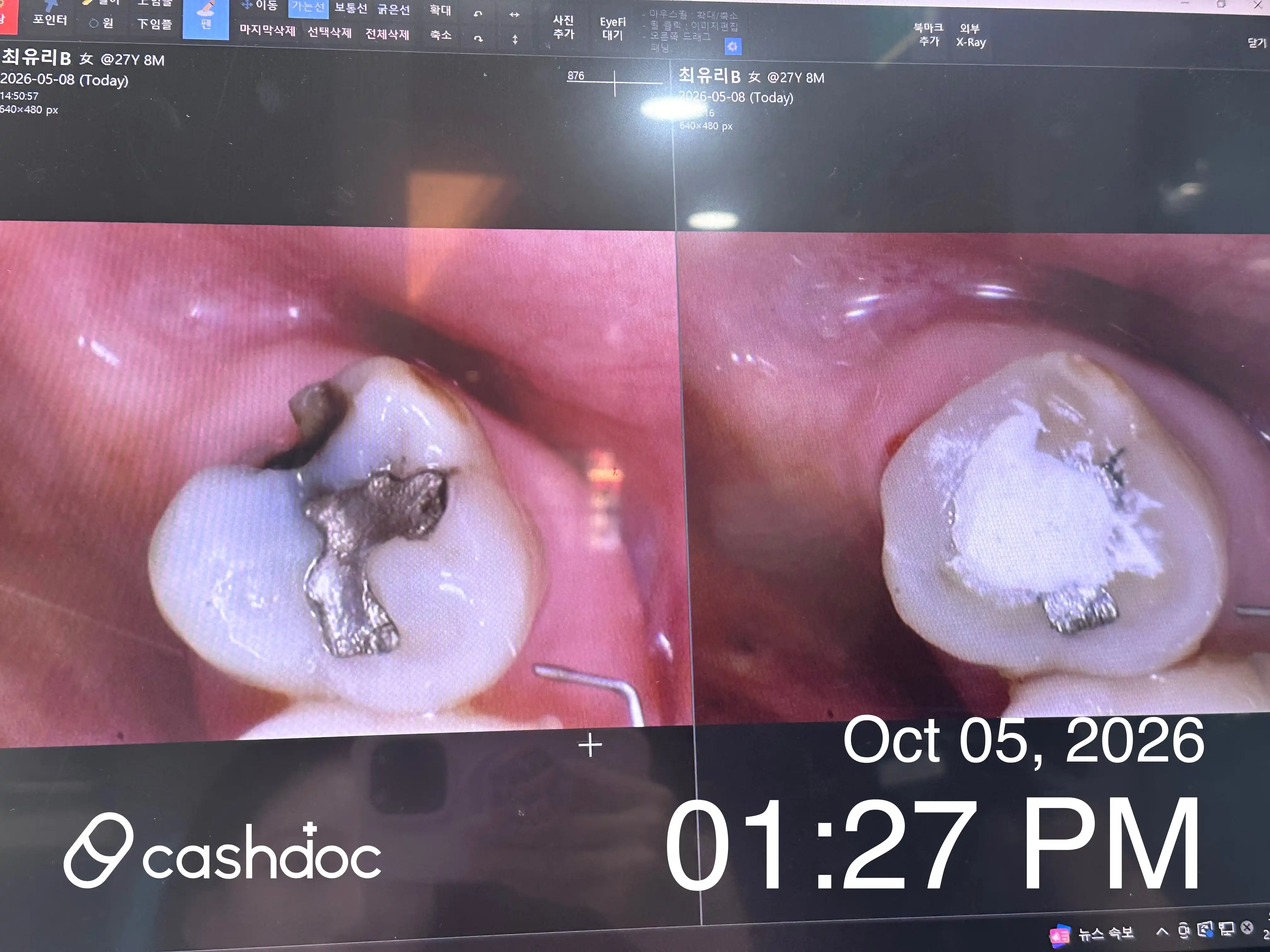 Review photo