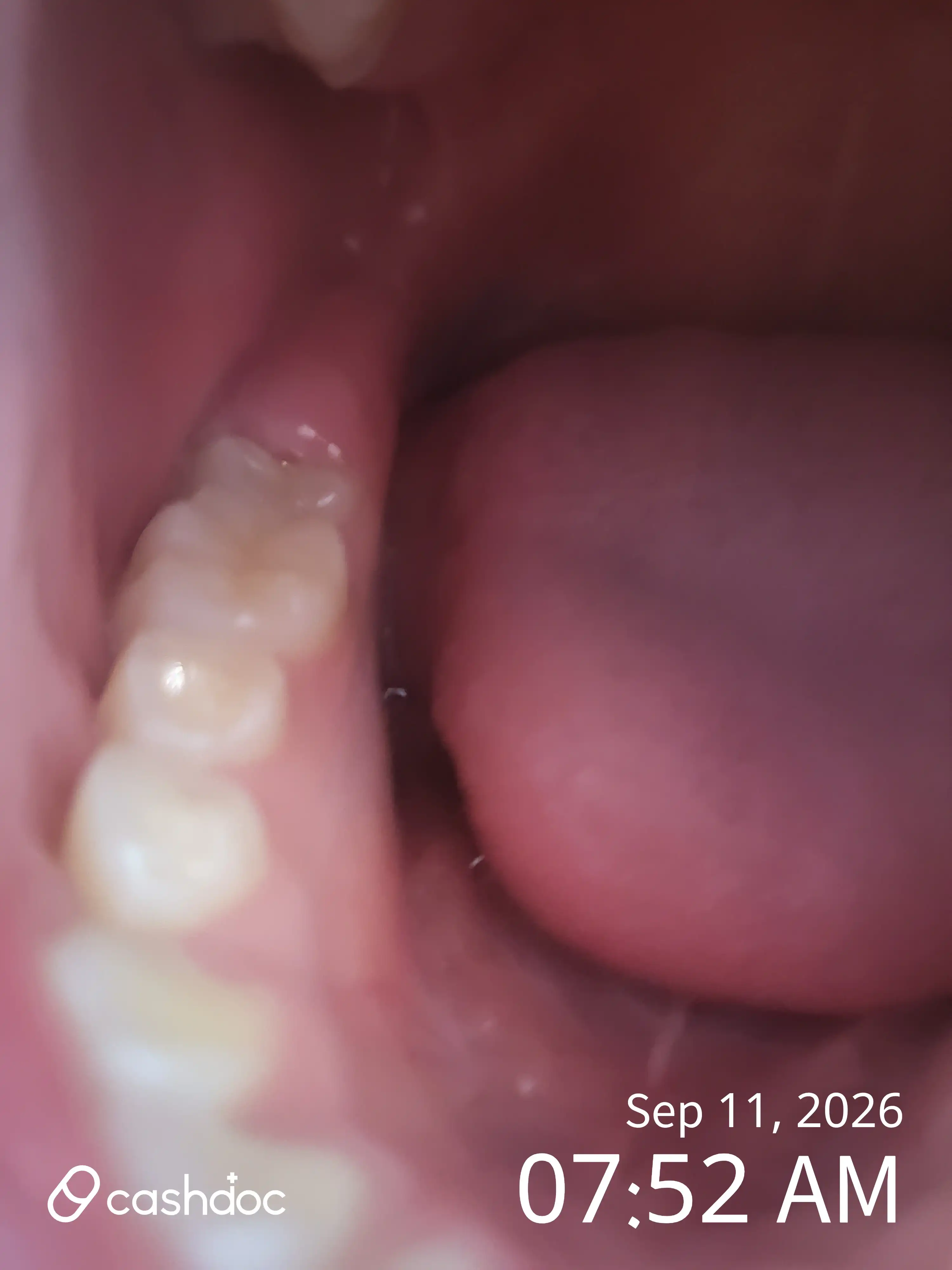 Review photo