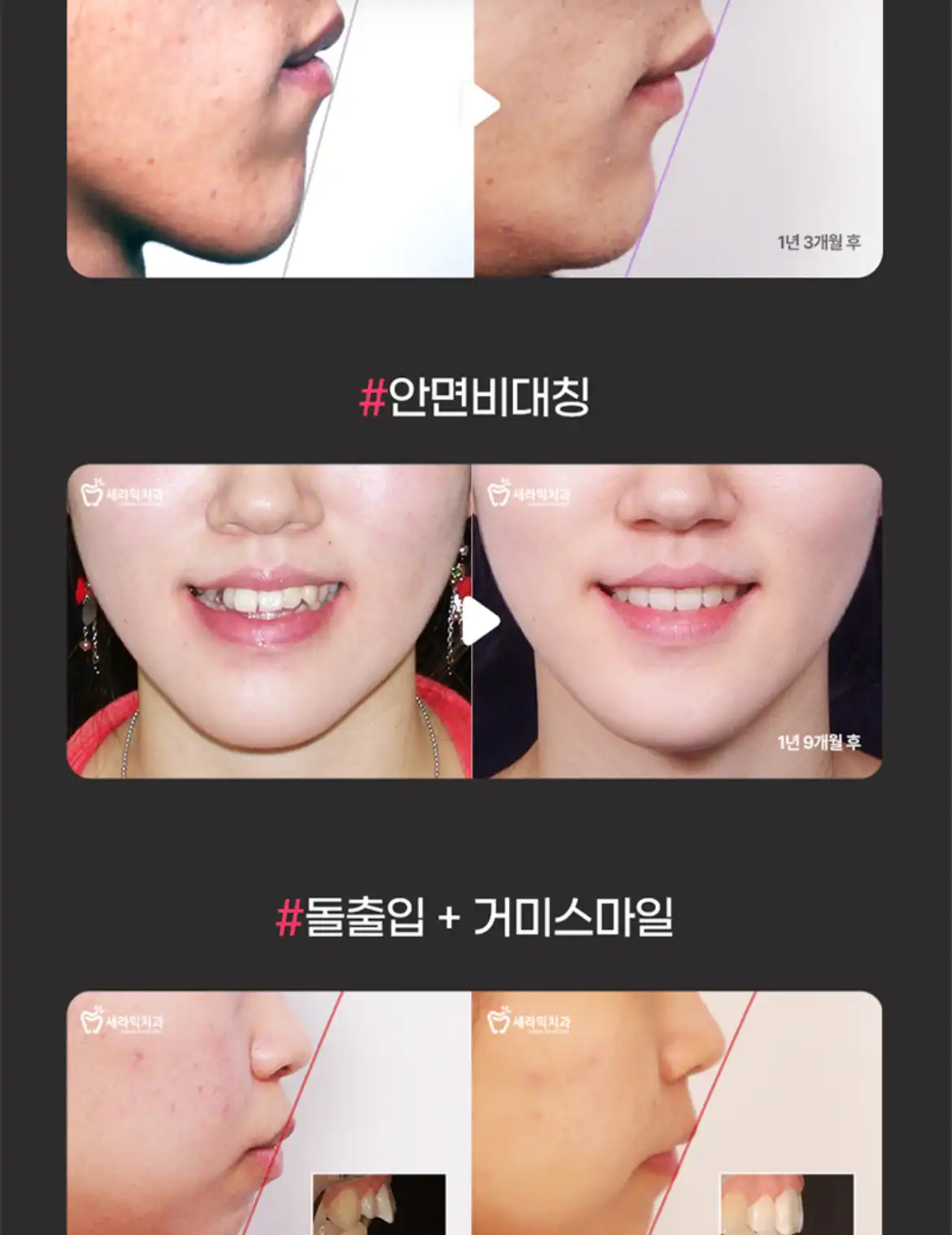 评价照片