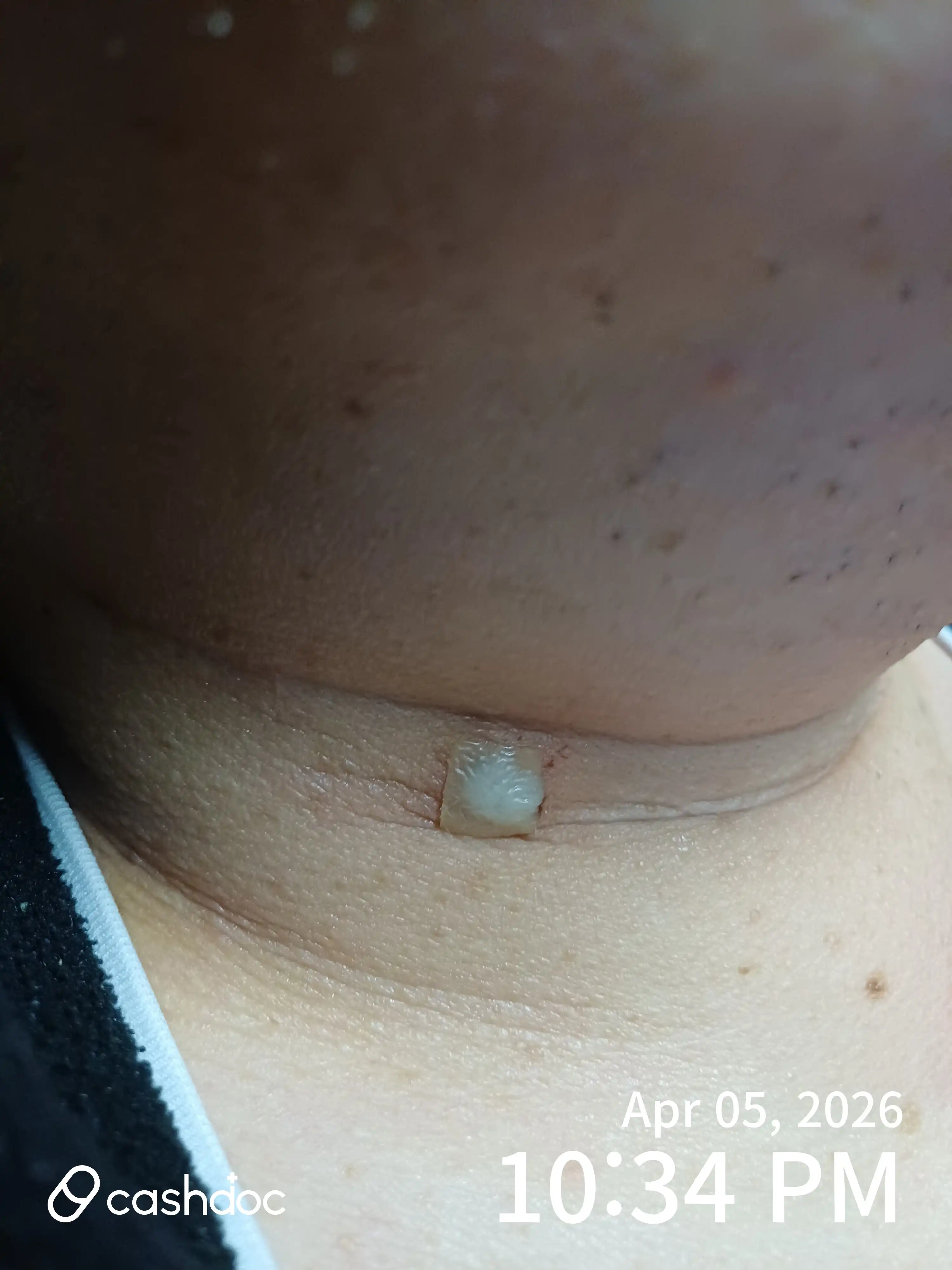 Review photo