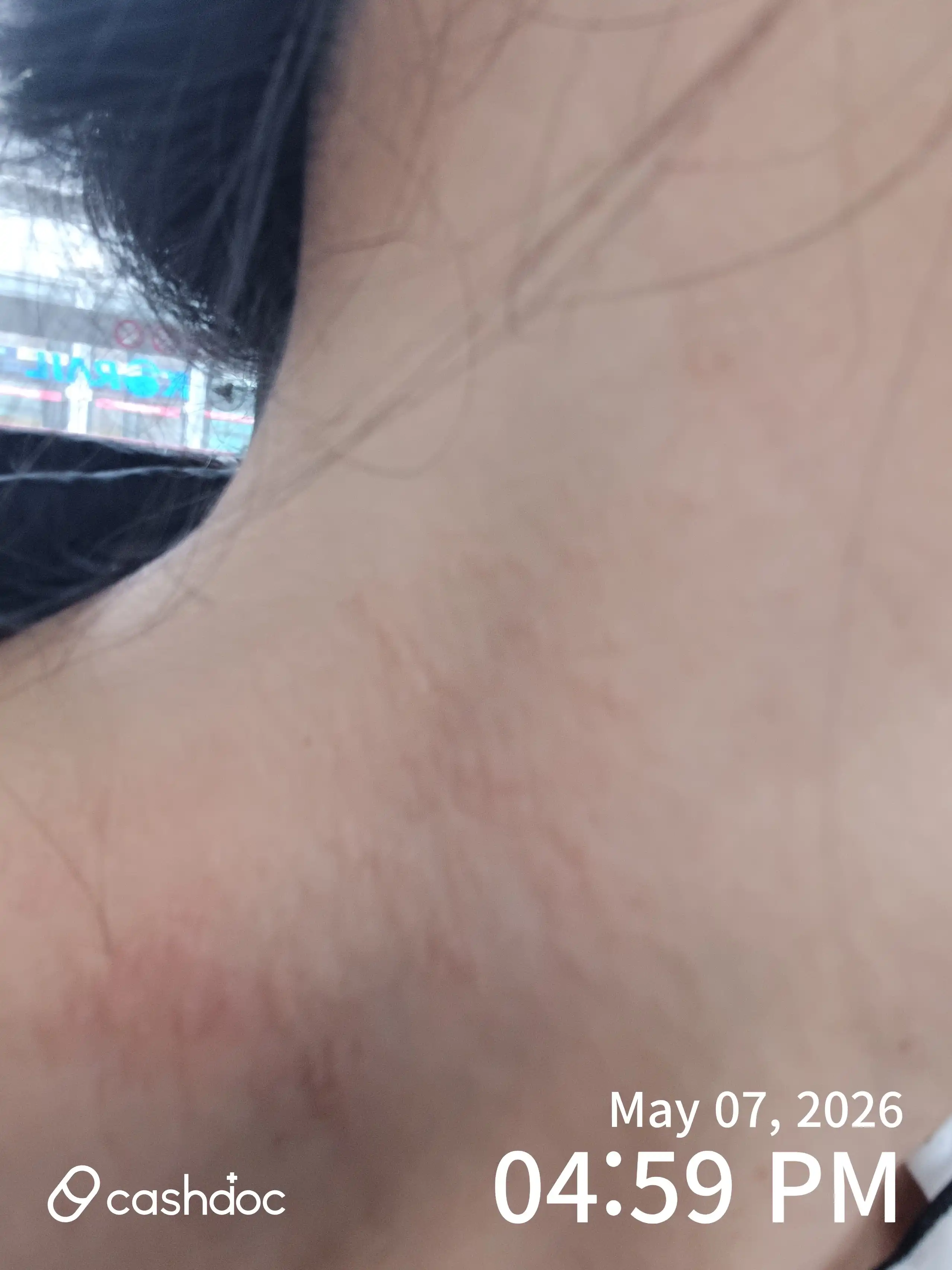 Review photo