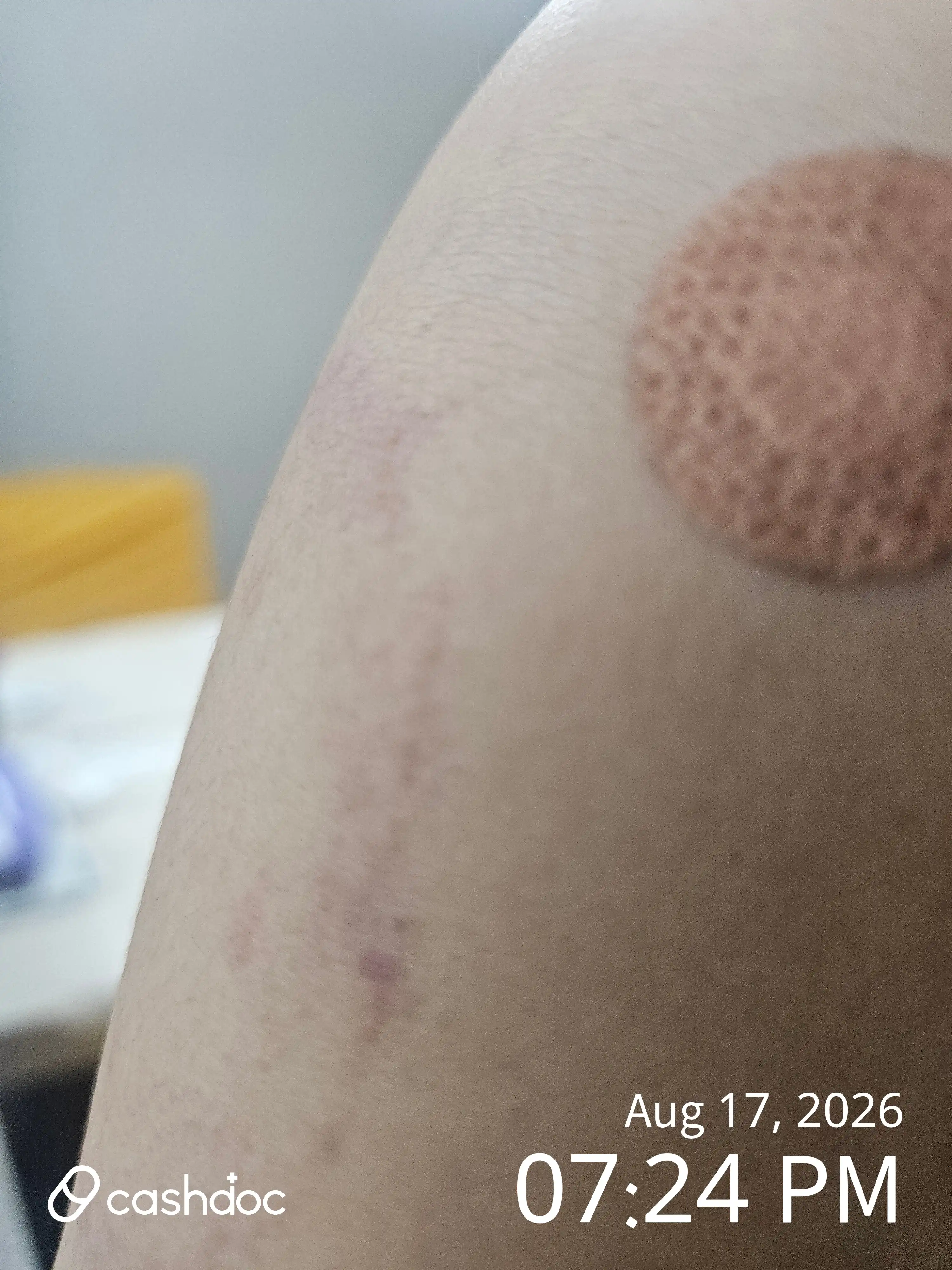 评价照片