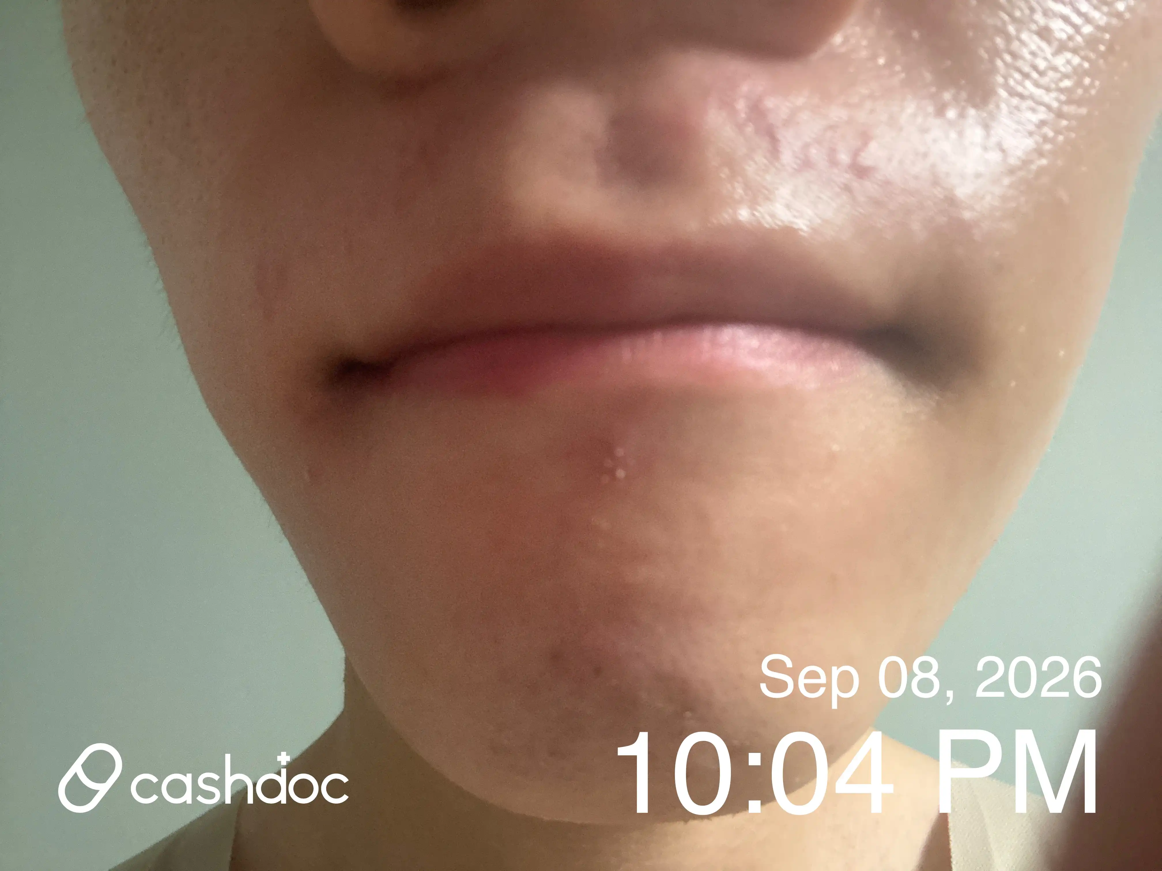 Review photo