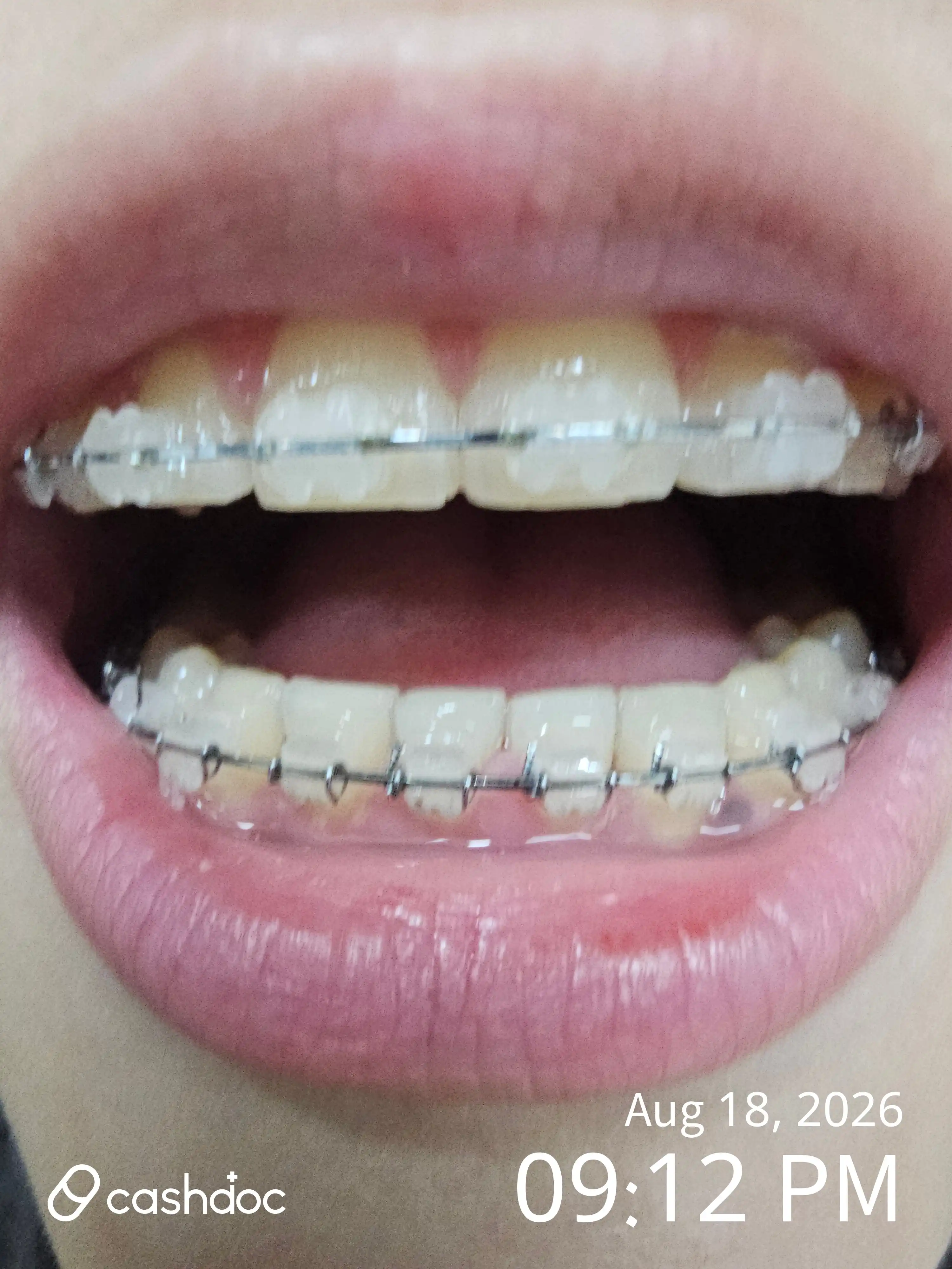 Review photo
