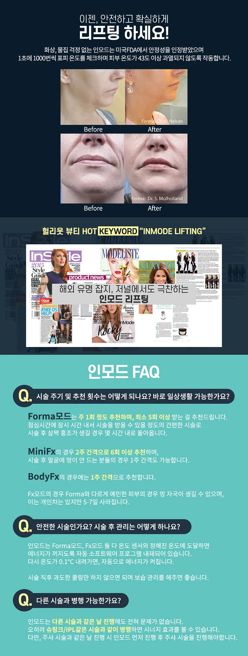 메이퓨어의원 목동점 헐리웃리프팅 #인모드 이벤트, 시술 상세 이미지