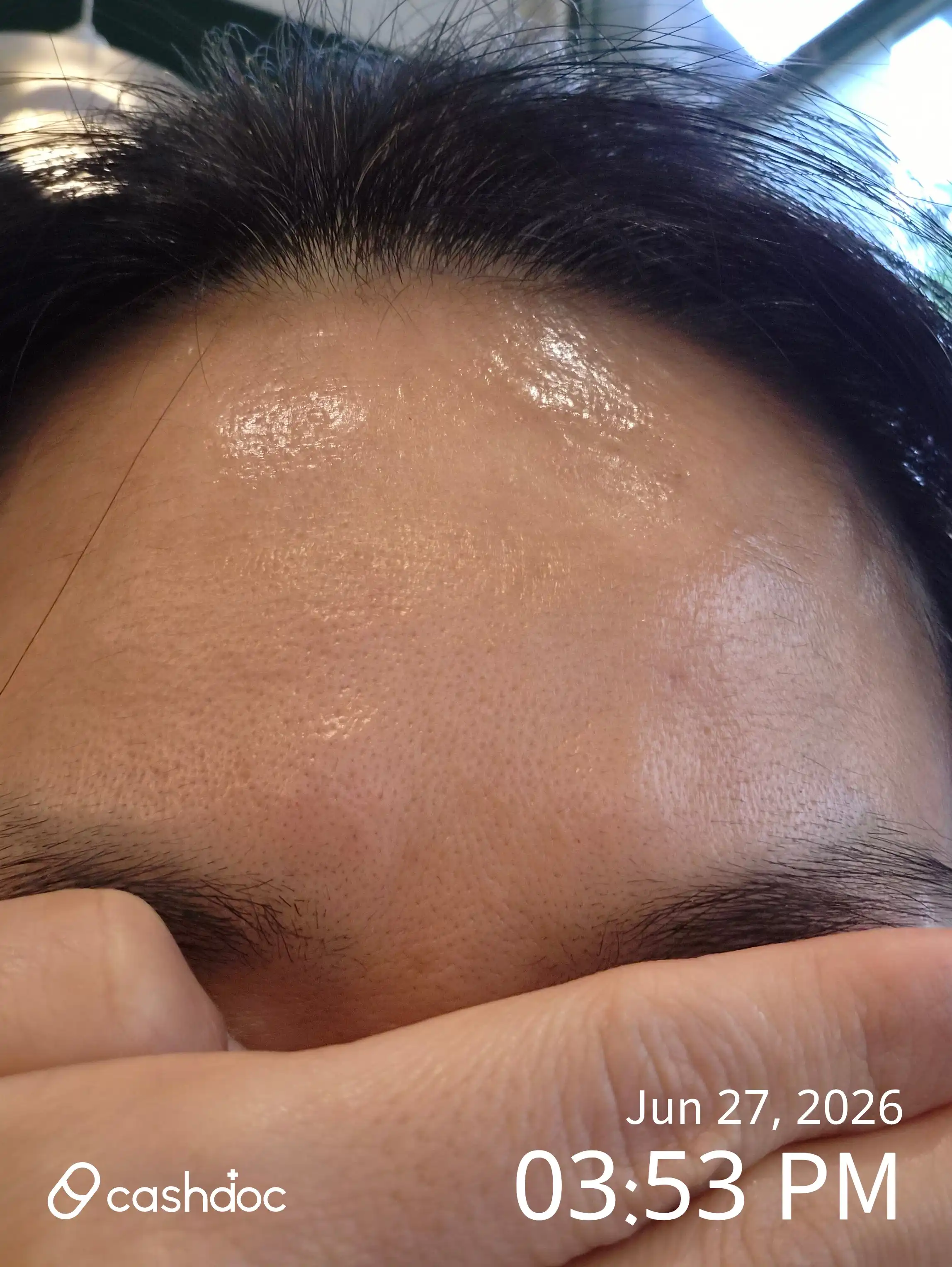 Review photo