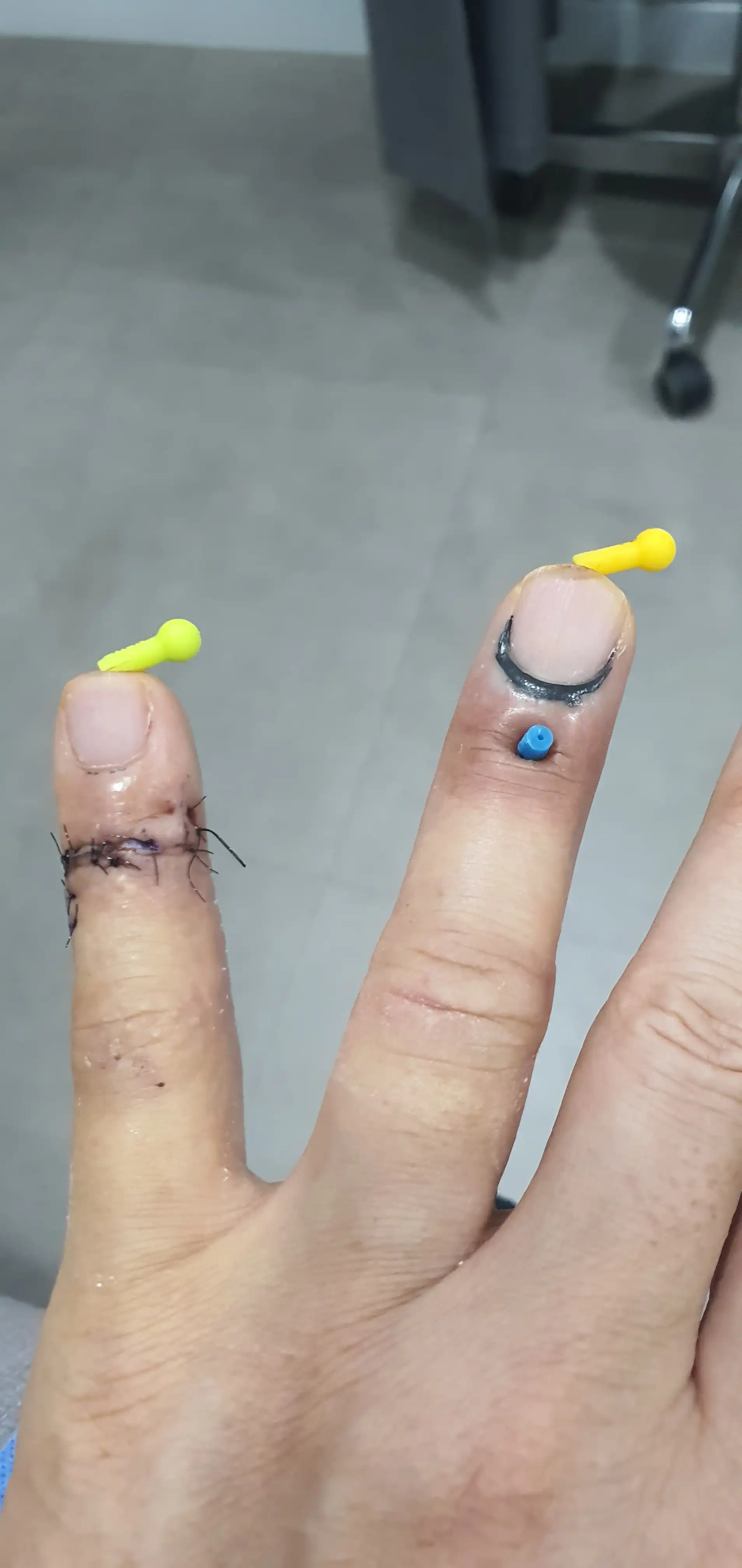 评价照片