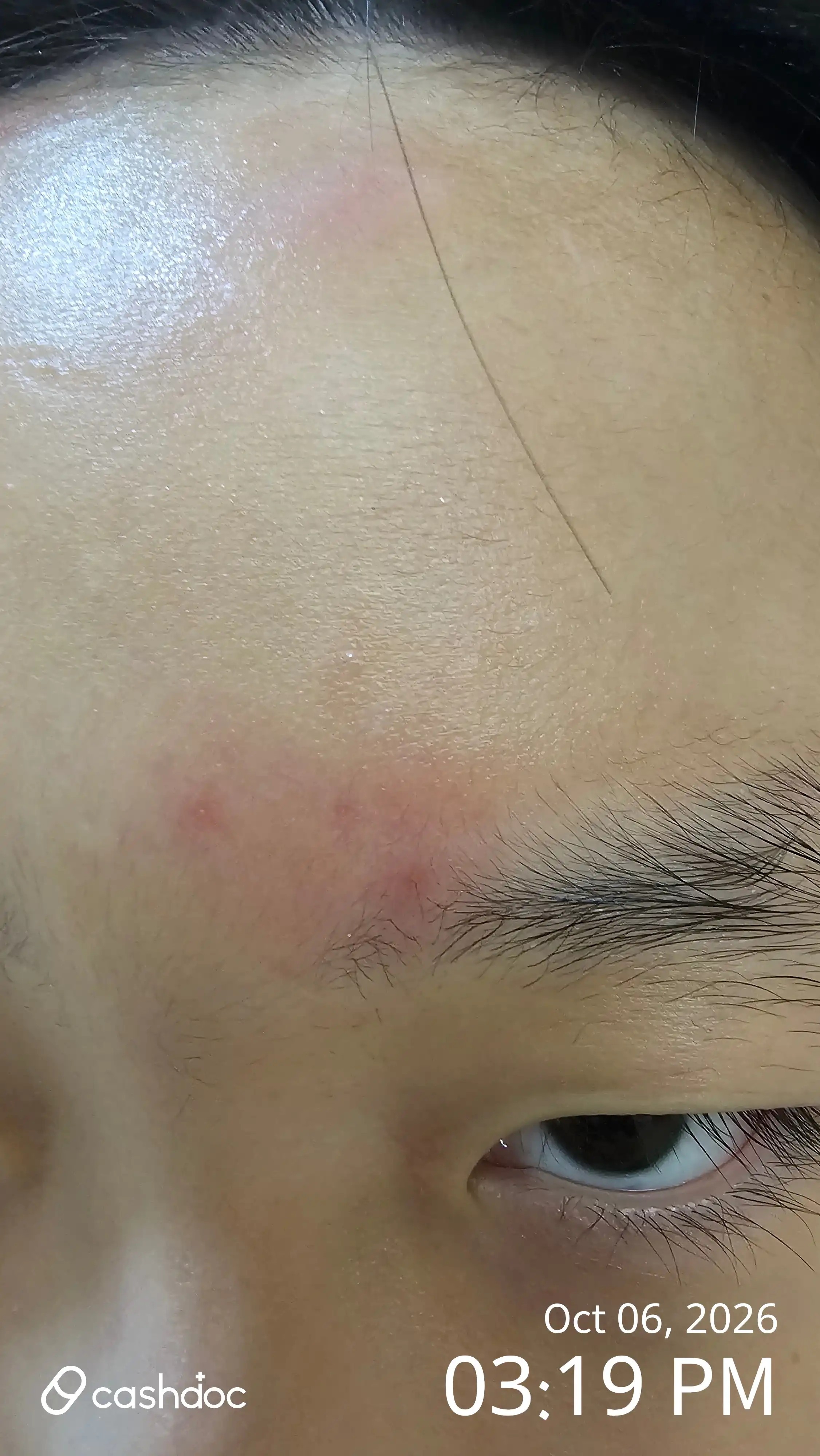 评价照片