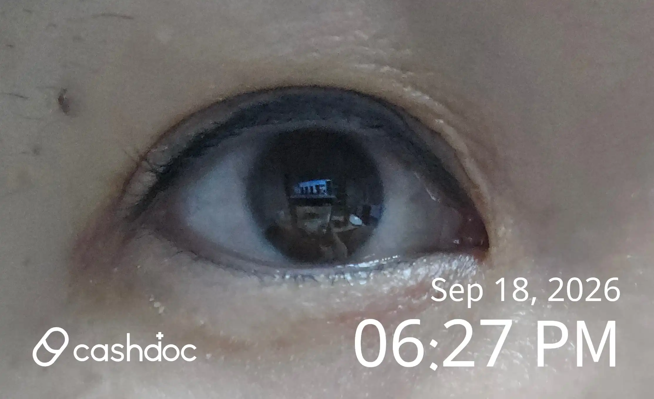 Review photo