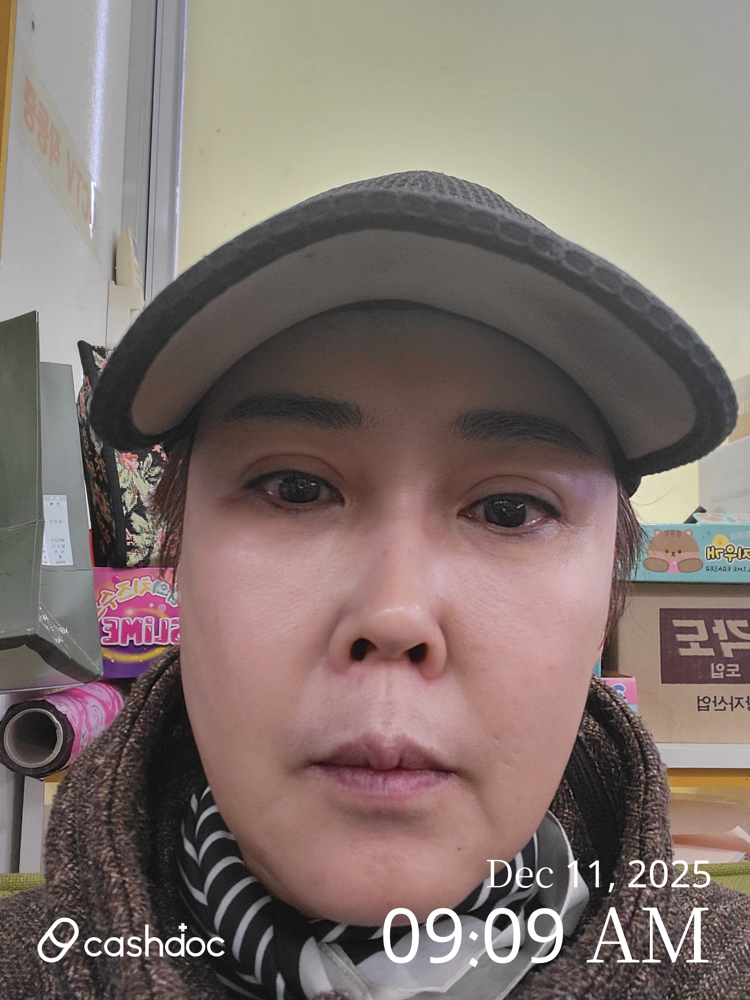 강남구 유앤아이치과의원에서 꼼꼼한 리프팅 경험