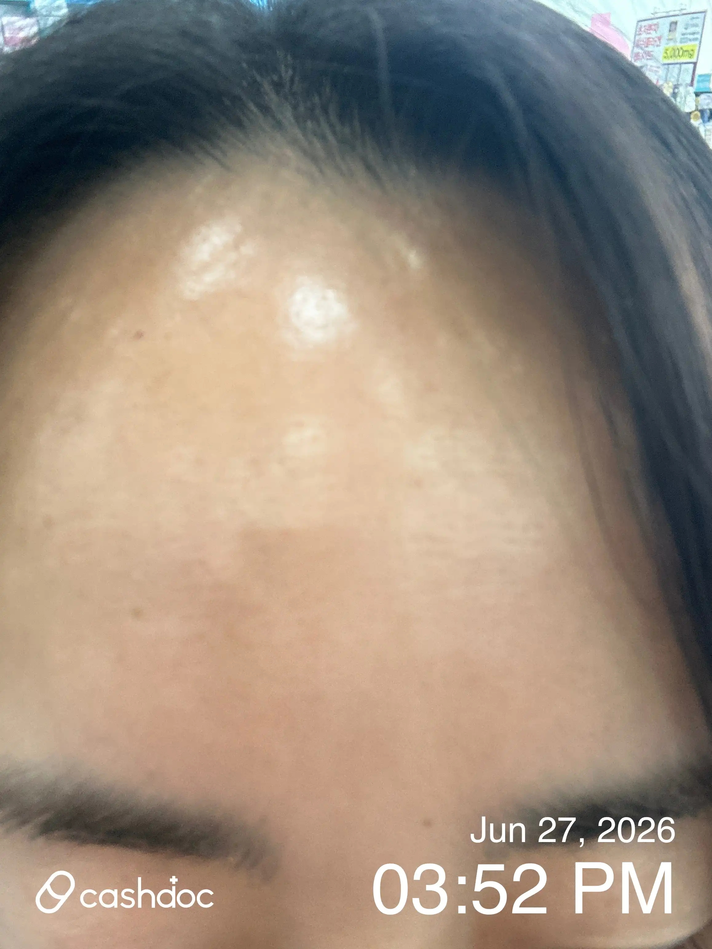 Review photo