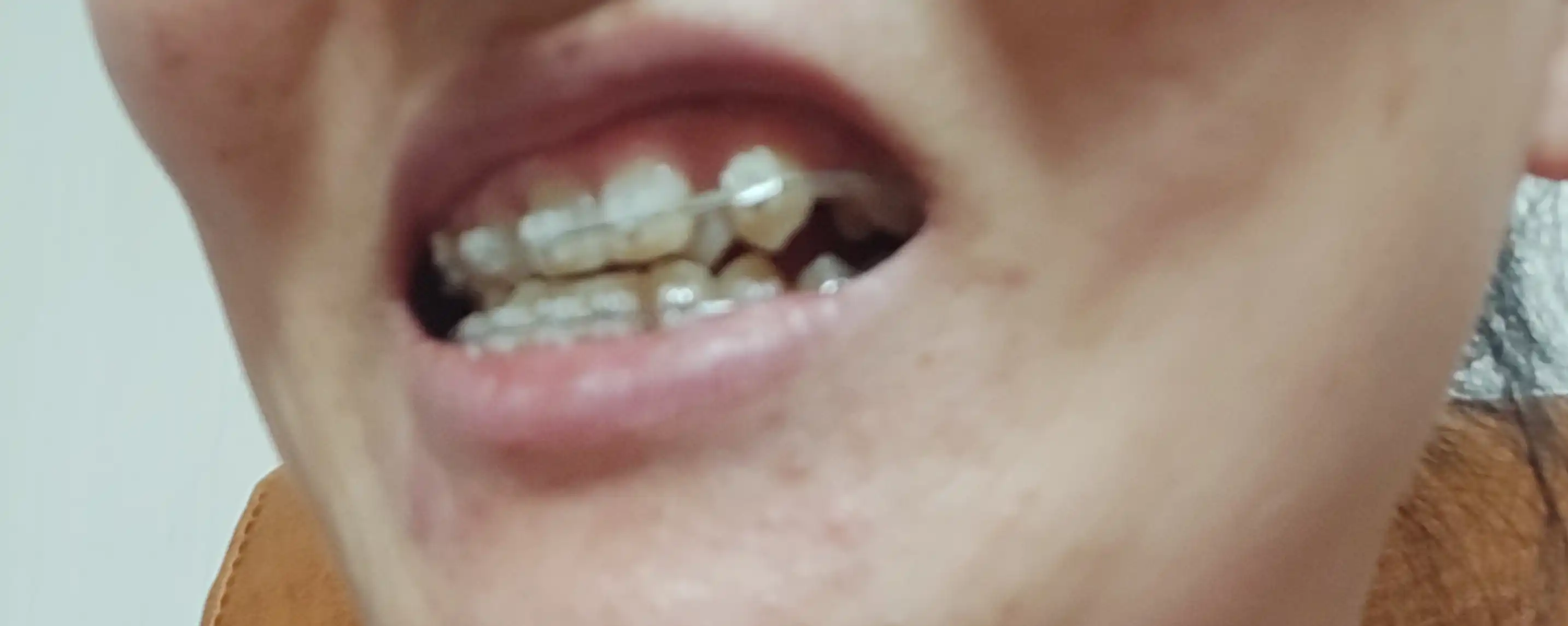 후