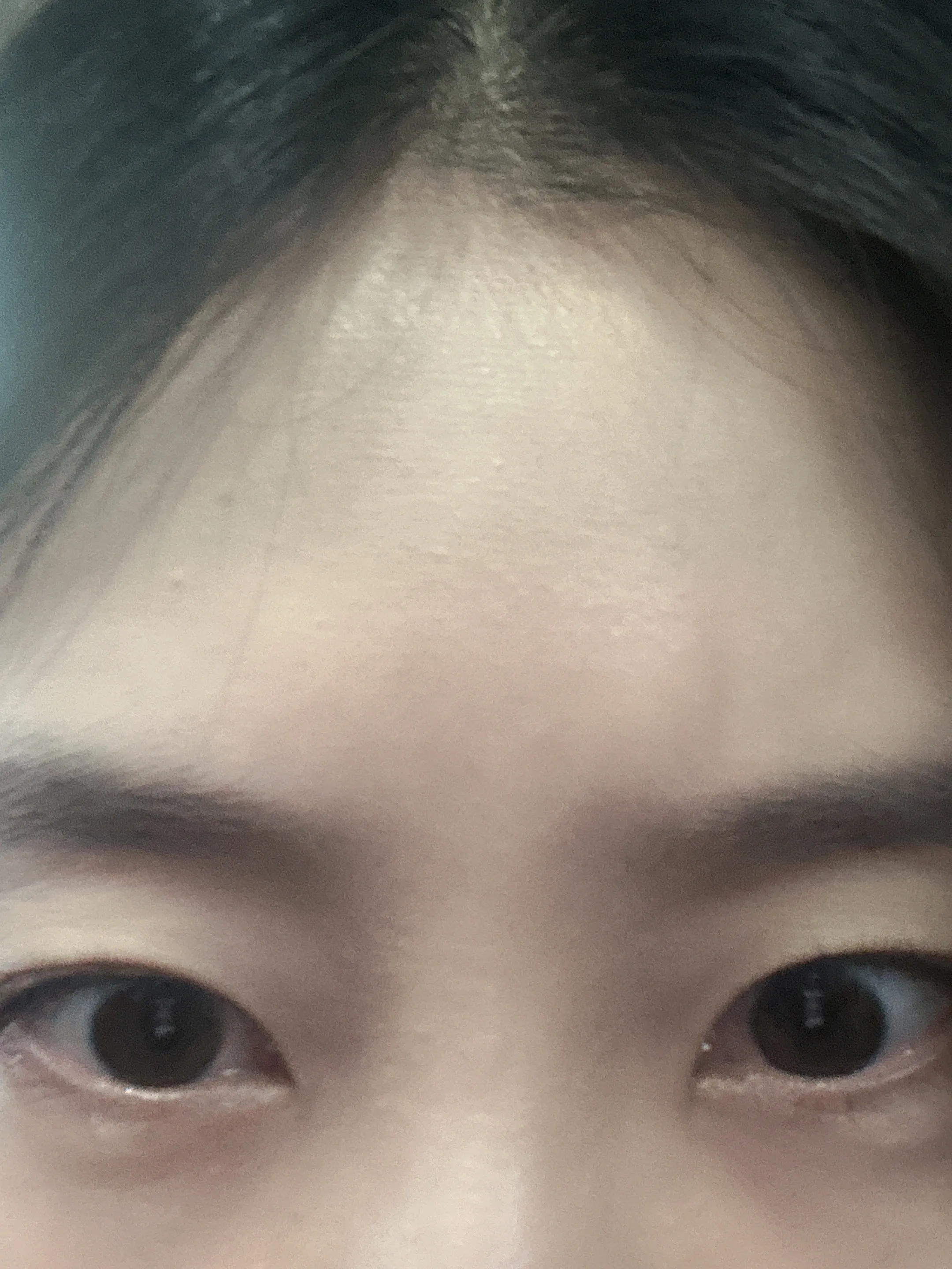 시술 전 사진