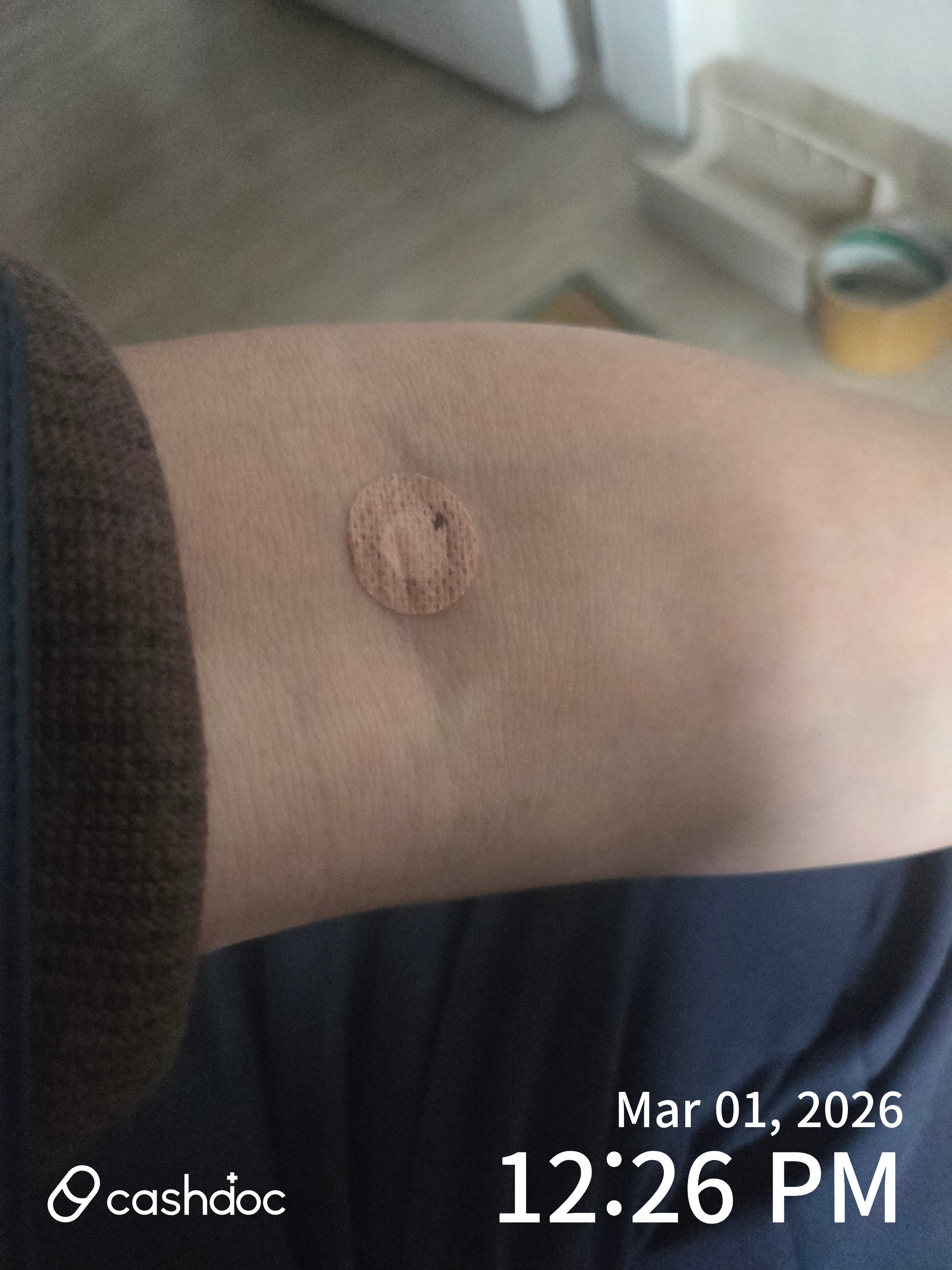 관악구 신동진내과의원, 혈액 검사 때 불편했어요